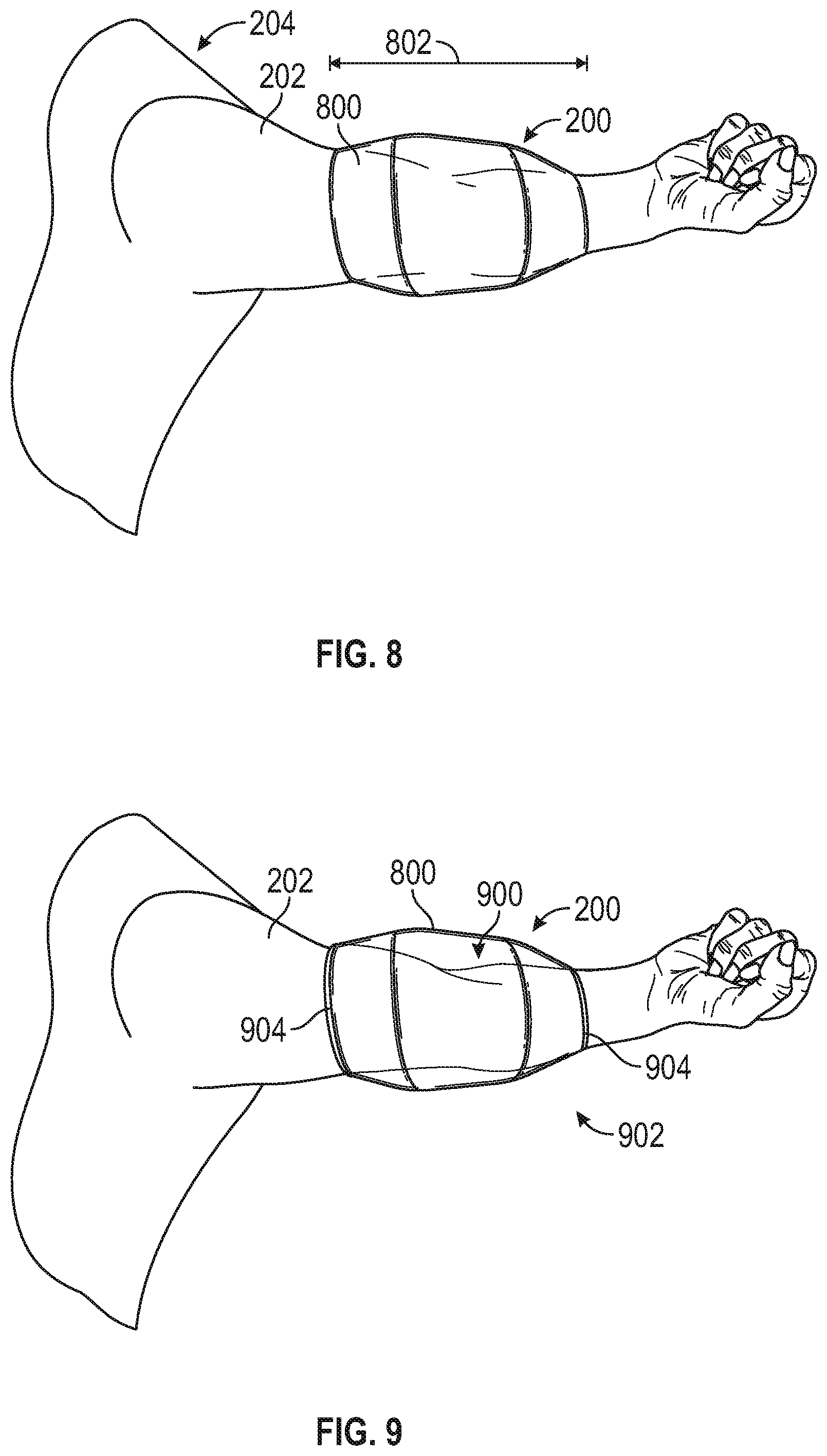 Patent US11793709 Figure 5 – Venous blood flow stimulator for extracorporeal therapy
