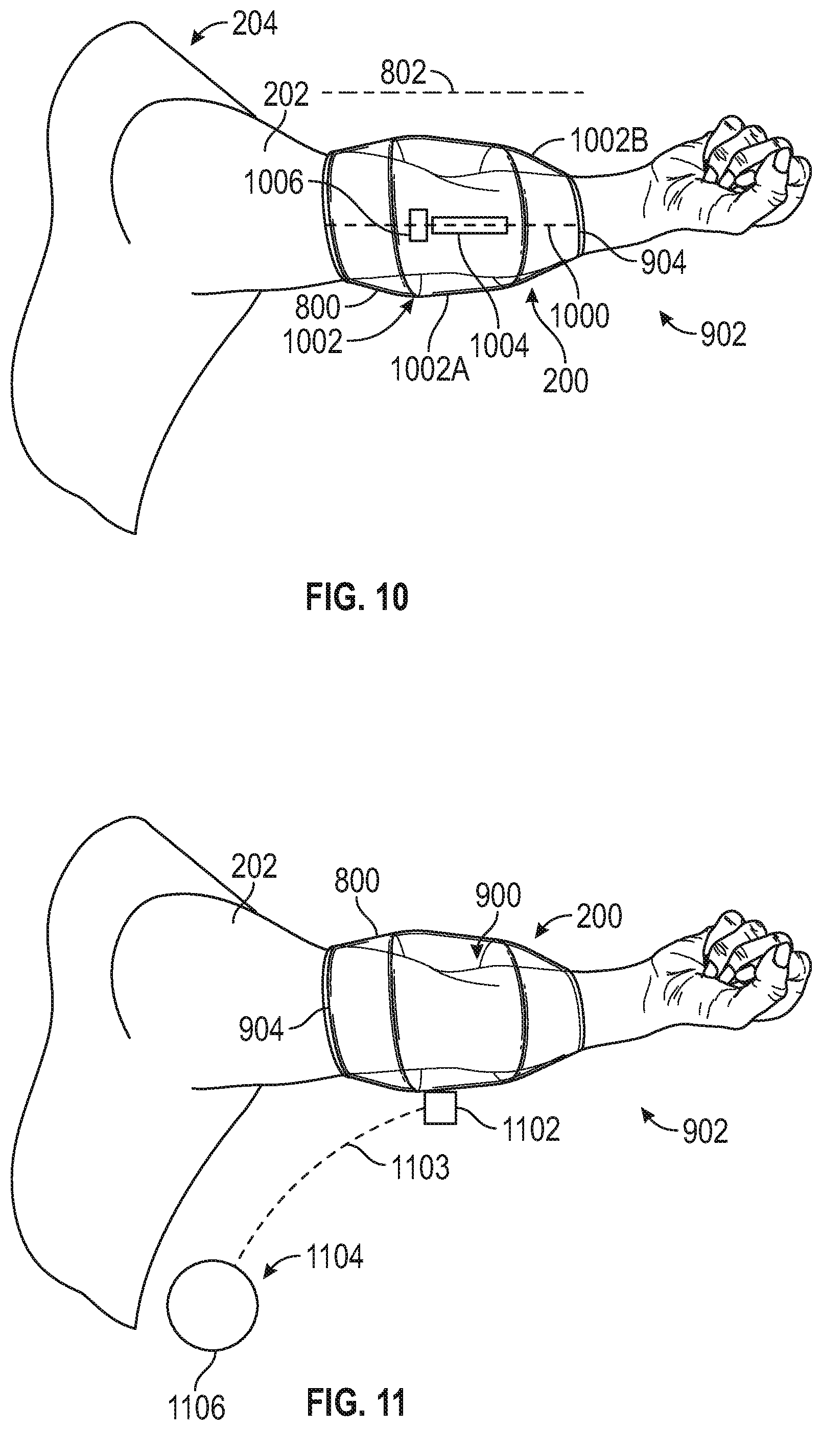 Patent US11793709 Figure 6 – Venous blood flow stimulator for extracorporeal therapy