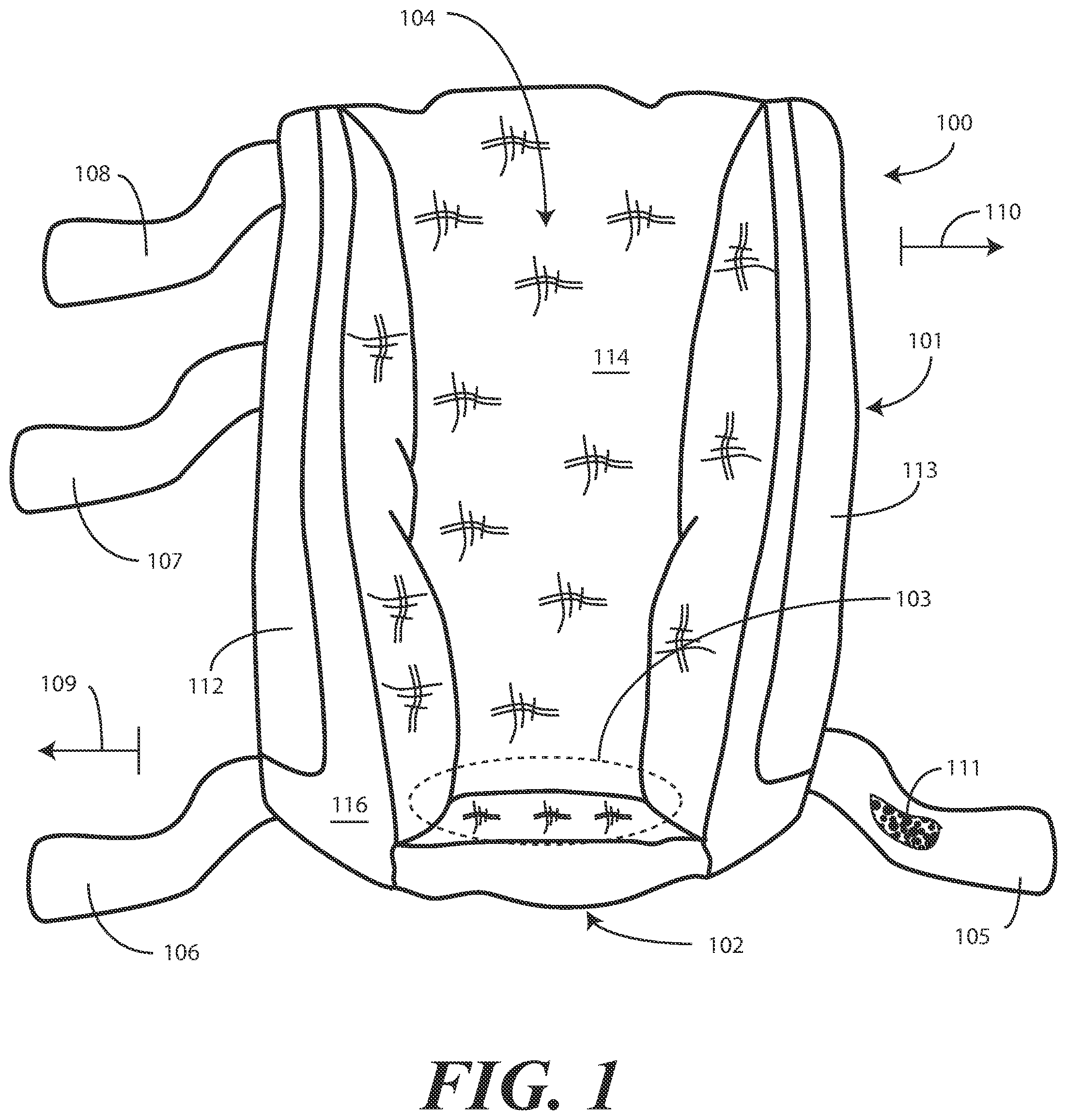 Patent US11793710 Figure 1 – Heel protector and corresponding rehabilitation systems and methods for using the same