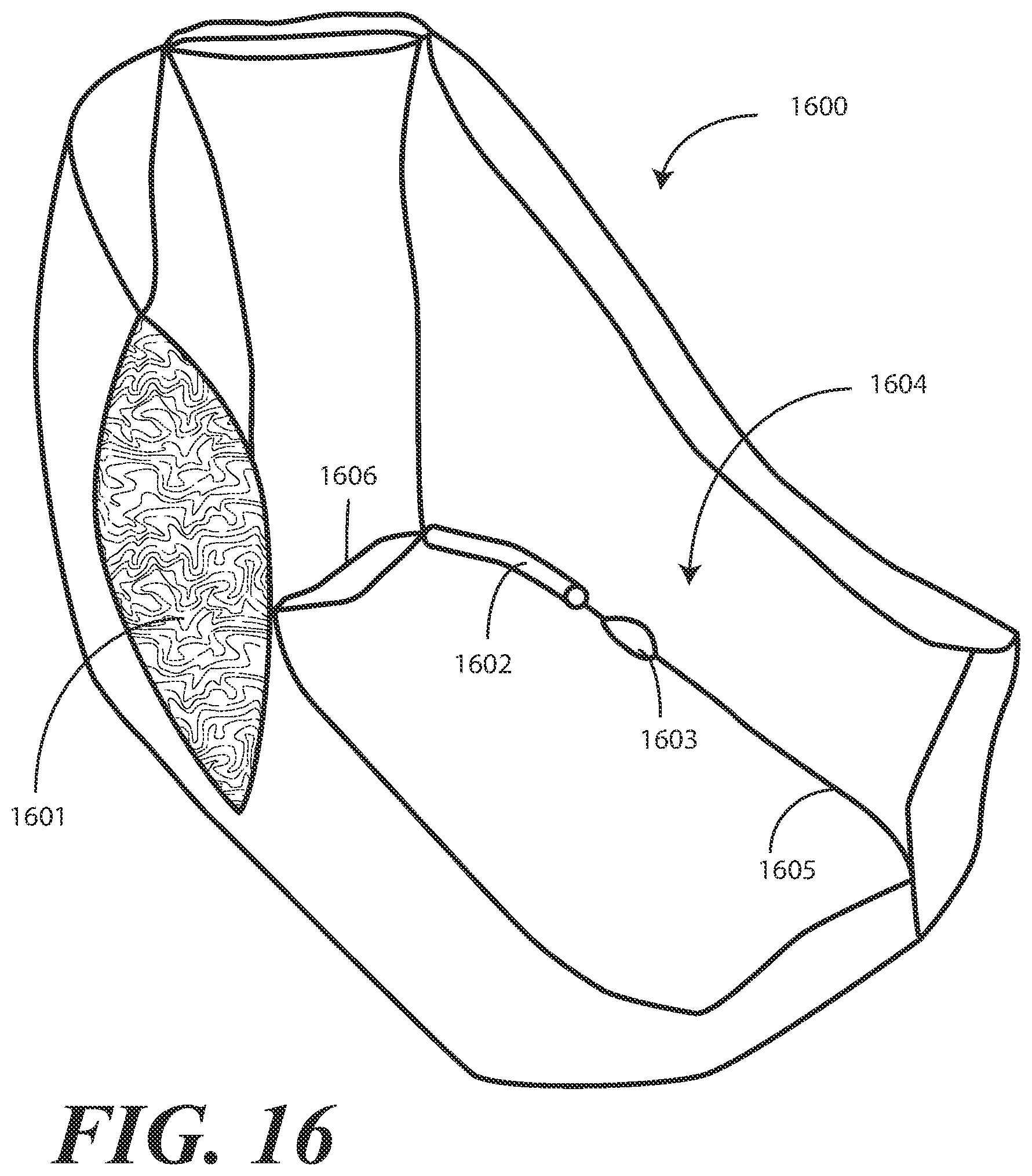 Patent US11793710 Figure 16 – Heel protector and corresponding rehabilitation systems and methods for using the same