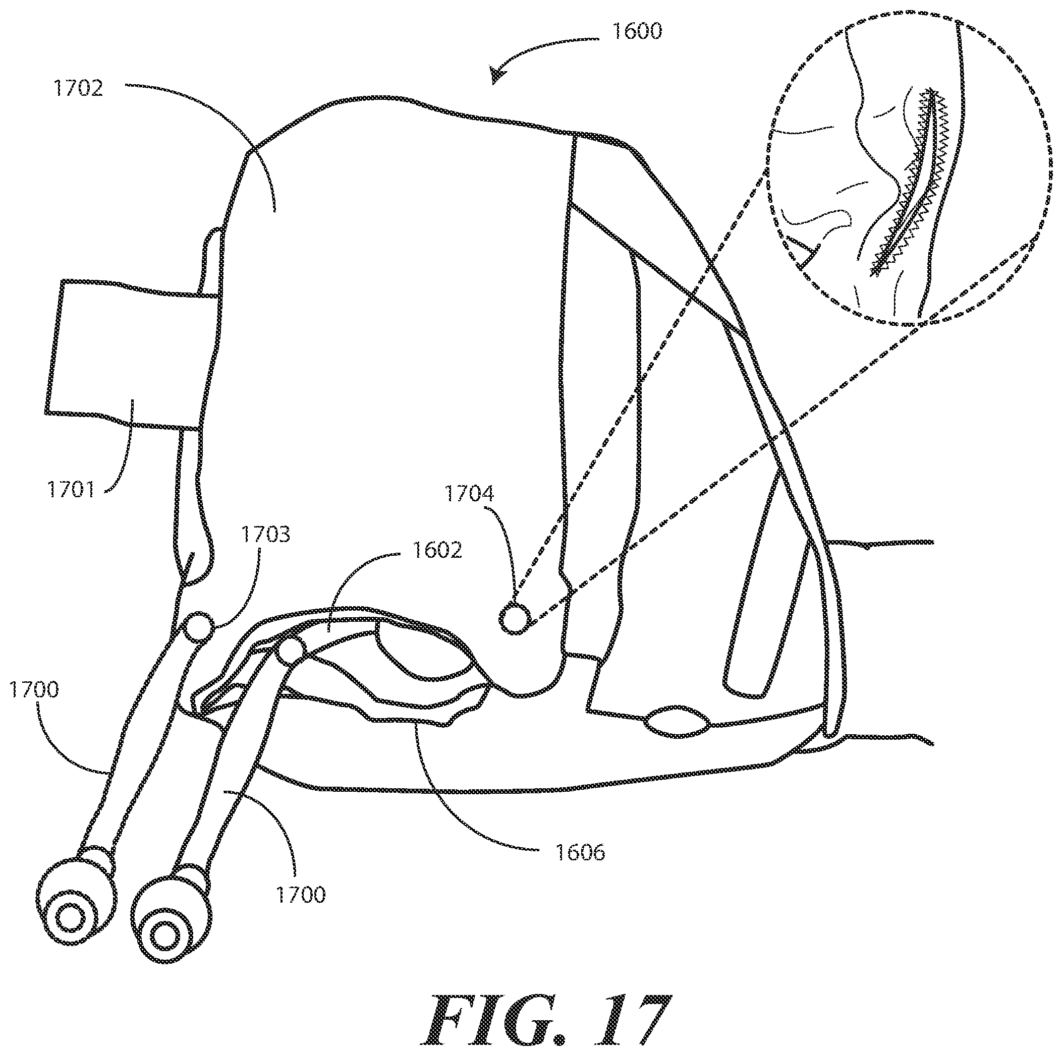 Patent US11793710 Figure 17 – Heel protector and corresponding rehabilitation systems and methods for using the same