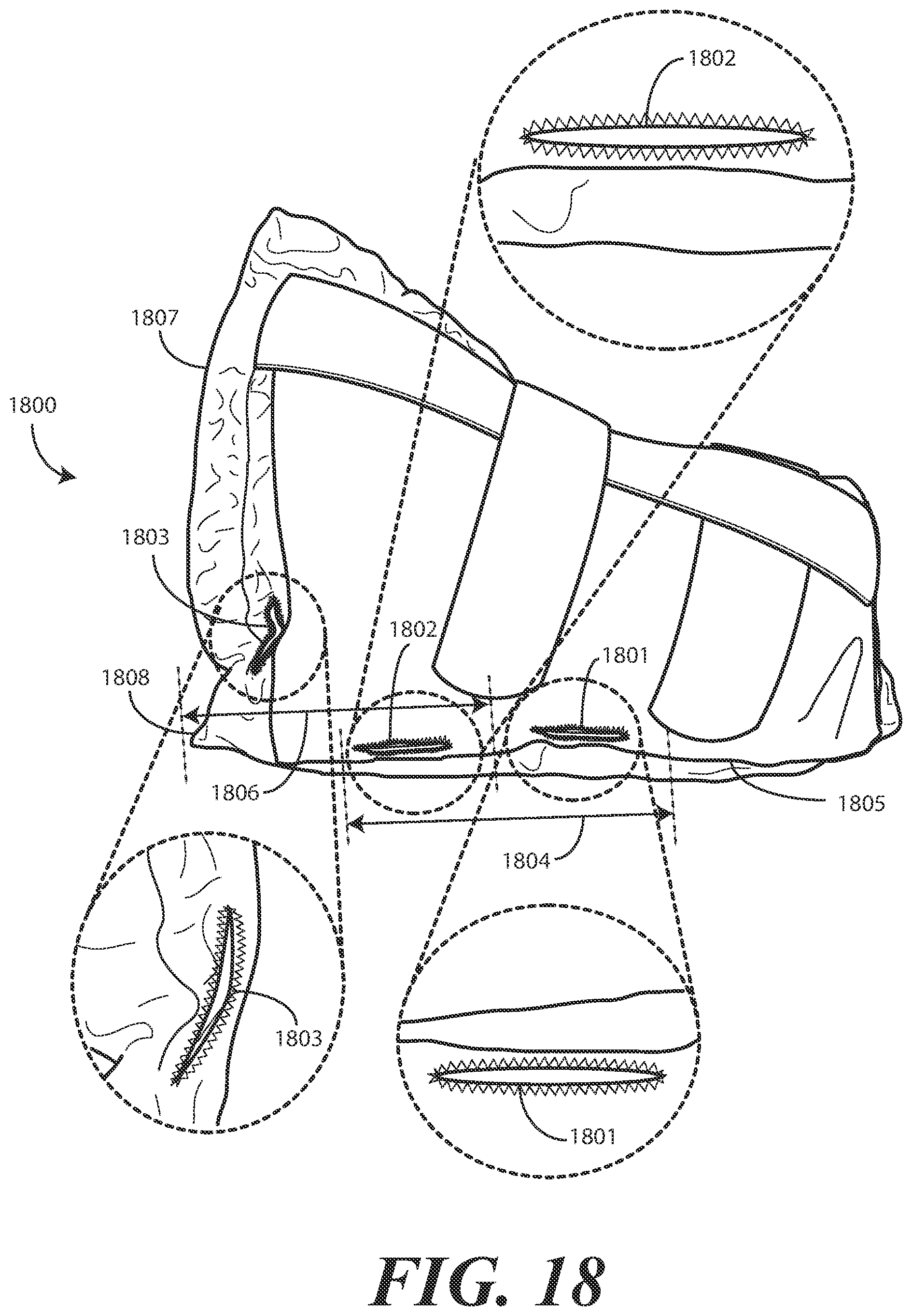 Patent US11793710 Figure 18 – Heel protector and corresponding rehabilitation systems and methods for using the same