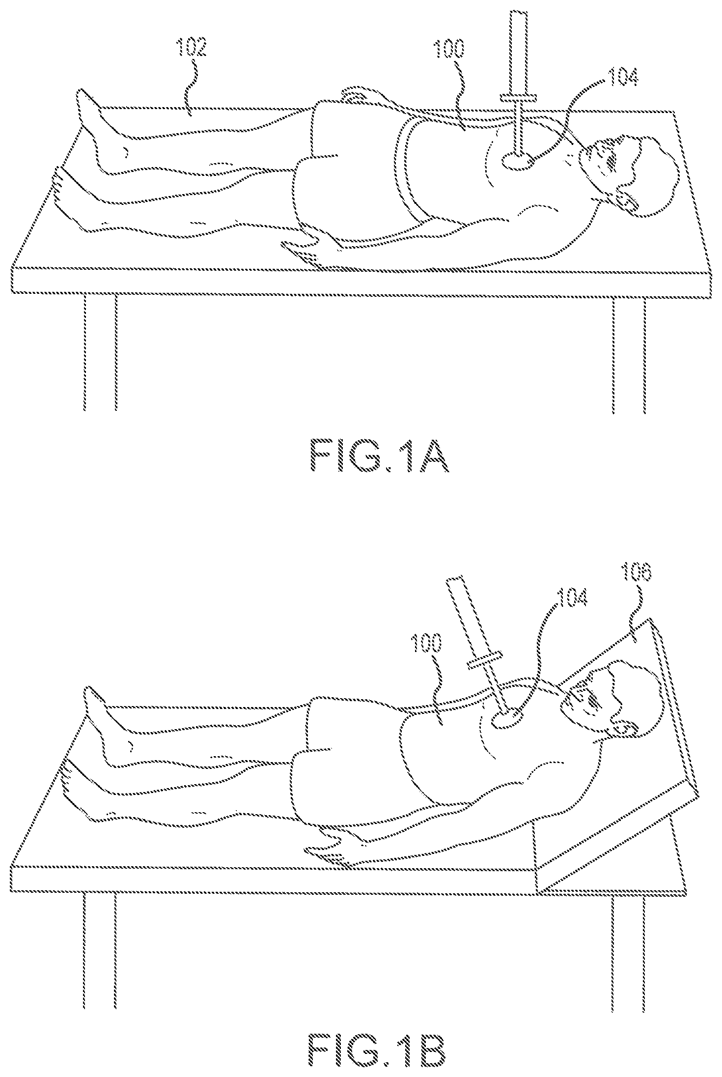 Patent US11793714 Figure 1 – Support devices for head up cardiopulmonary resuscitation