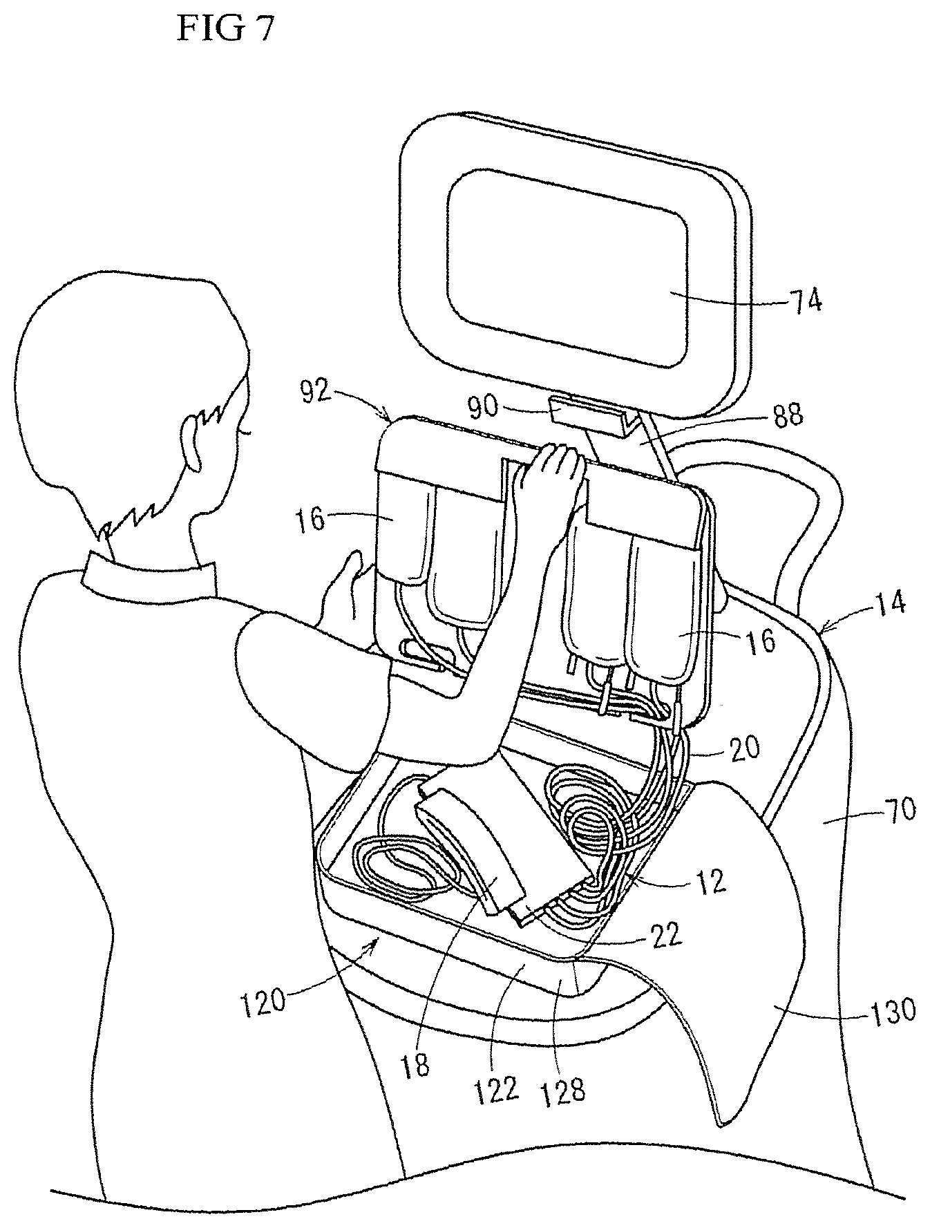 Patent US11793720 Figure 7 – Medical bag hanger and blood collection device package
