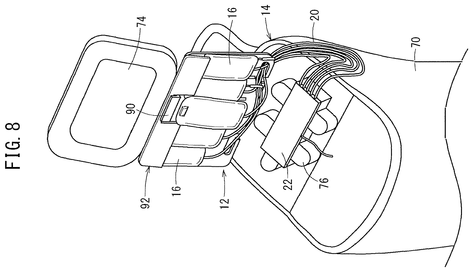 Patent US11793720 Figure 8 – Medical bag hanger and blood collection device package