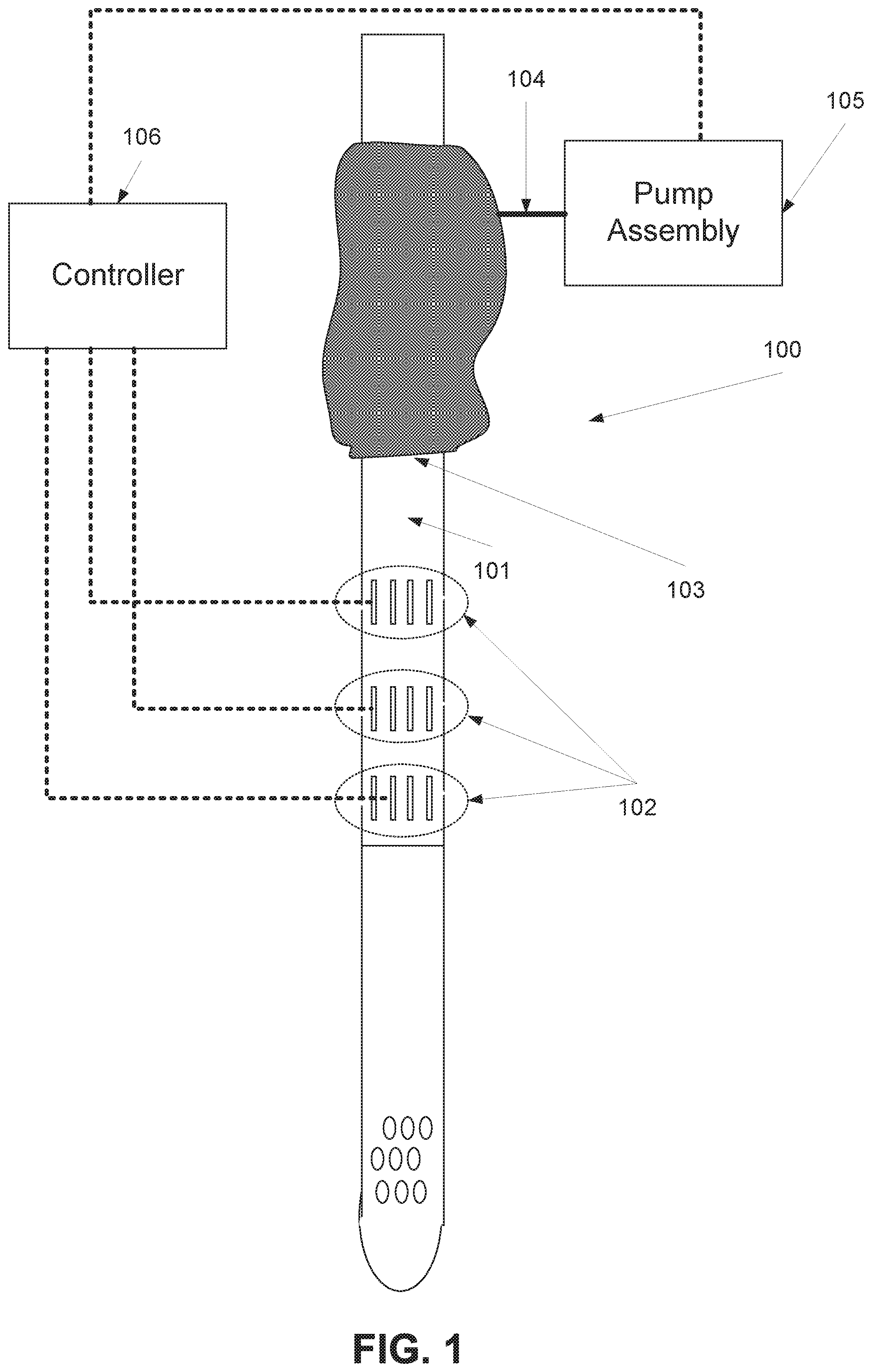 Patent US11793728 Figure 1 – Method and device of detecting and/or blocking reflux