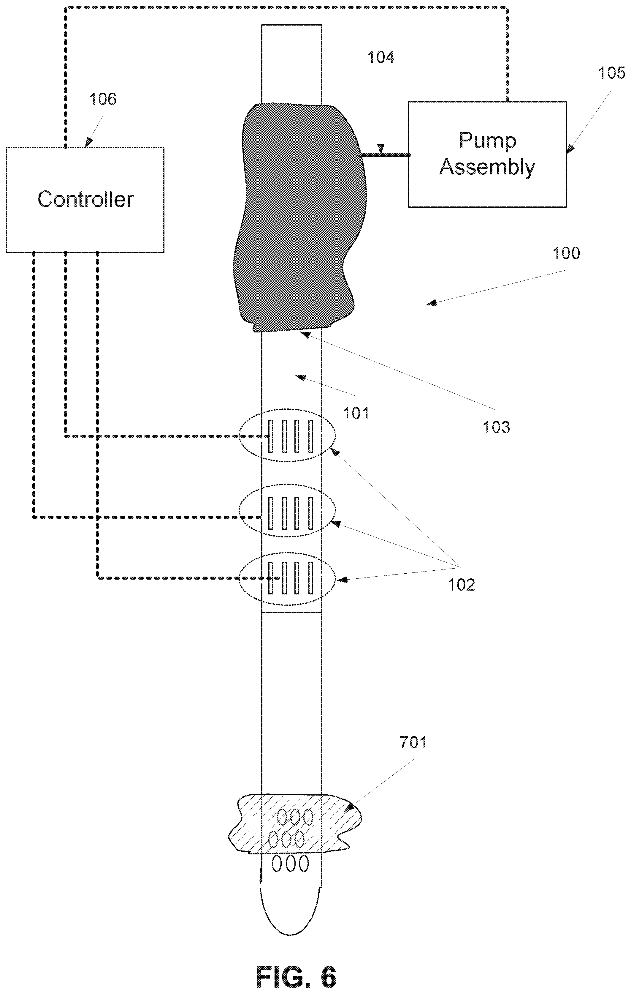 Patent US11793728 Figure 6 – Method and device of detecting and/or blocking reflux