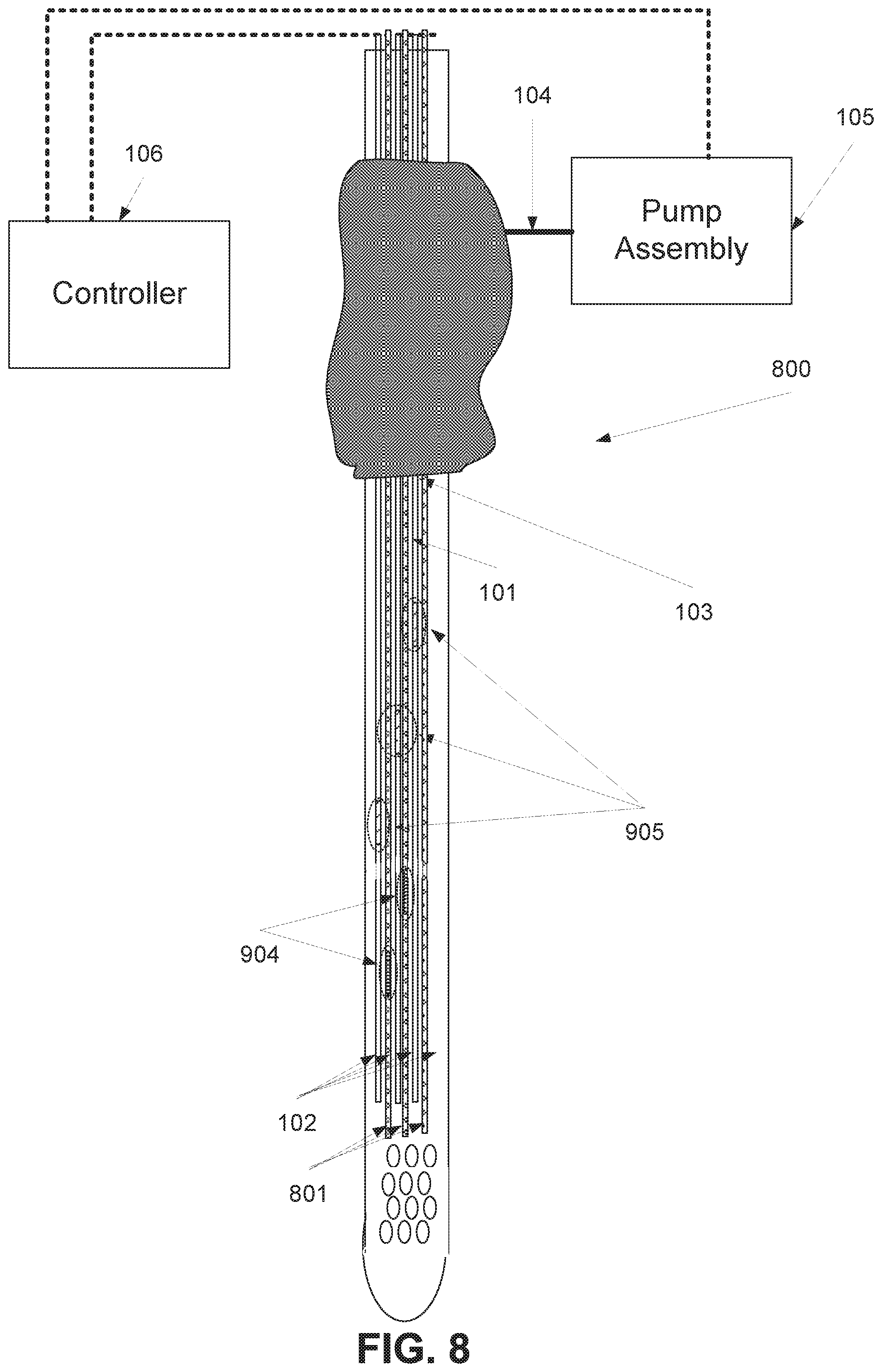 Patent US11793728 Figure 8 – Method and device of detecting and/or blocking reflux