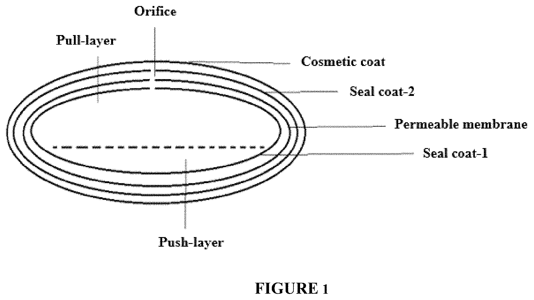 Patent US11793747 Figure 1 – Self-regulating osmotic gastroretentive drug delivery systems