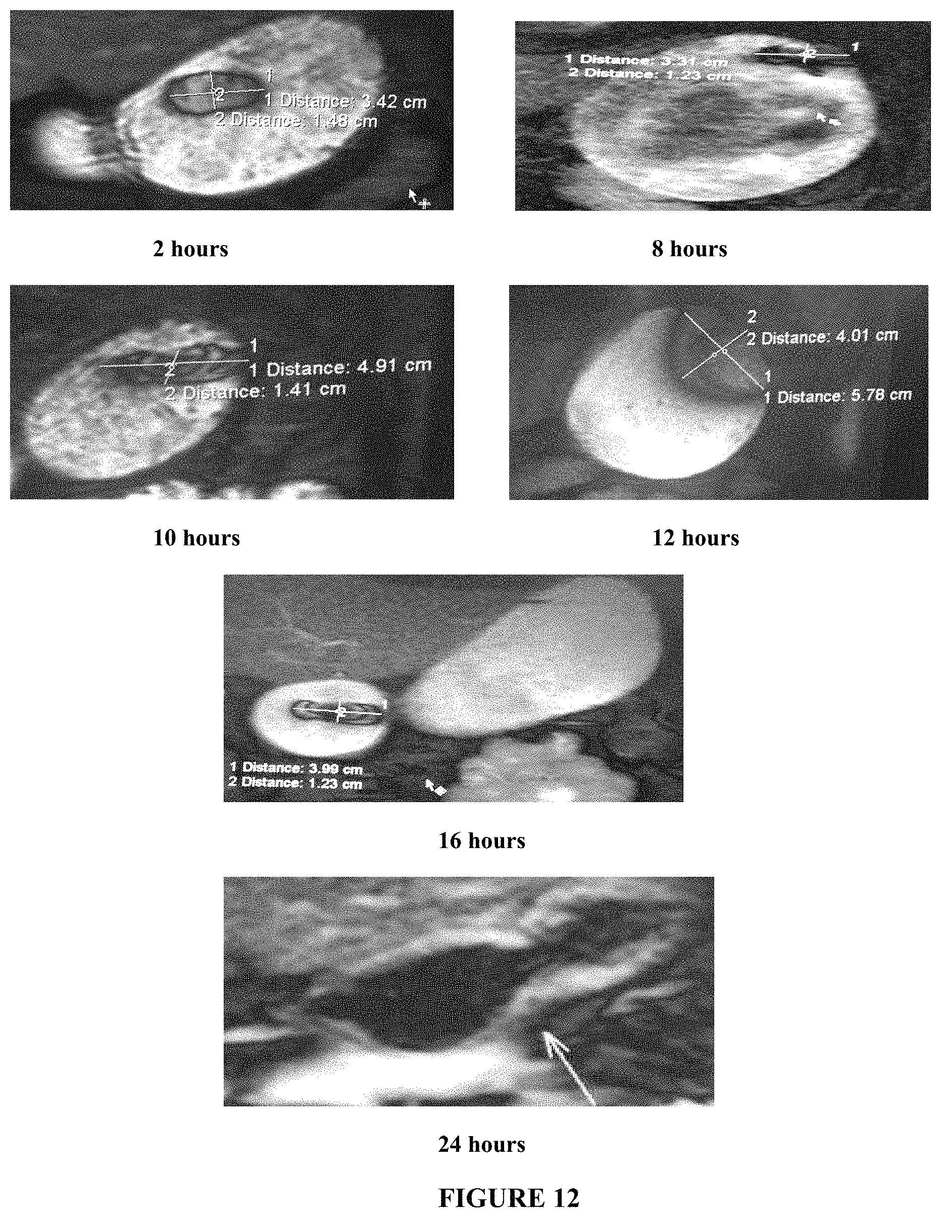 Patent US11793747 Figure 12 – Self-regulating osmotic gastroretentive drug delivery systems