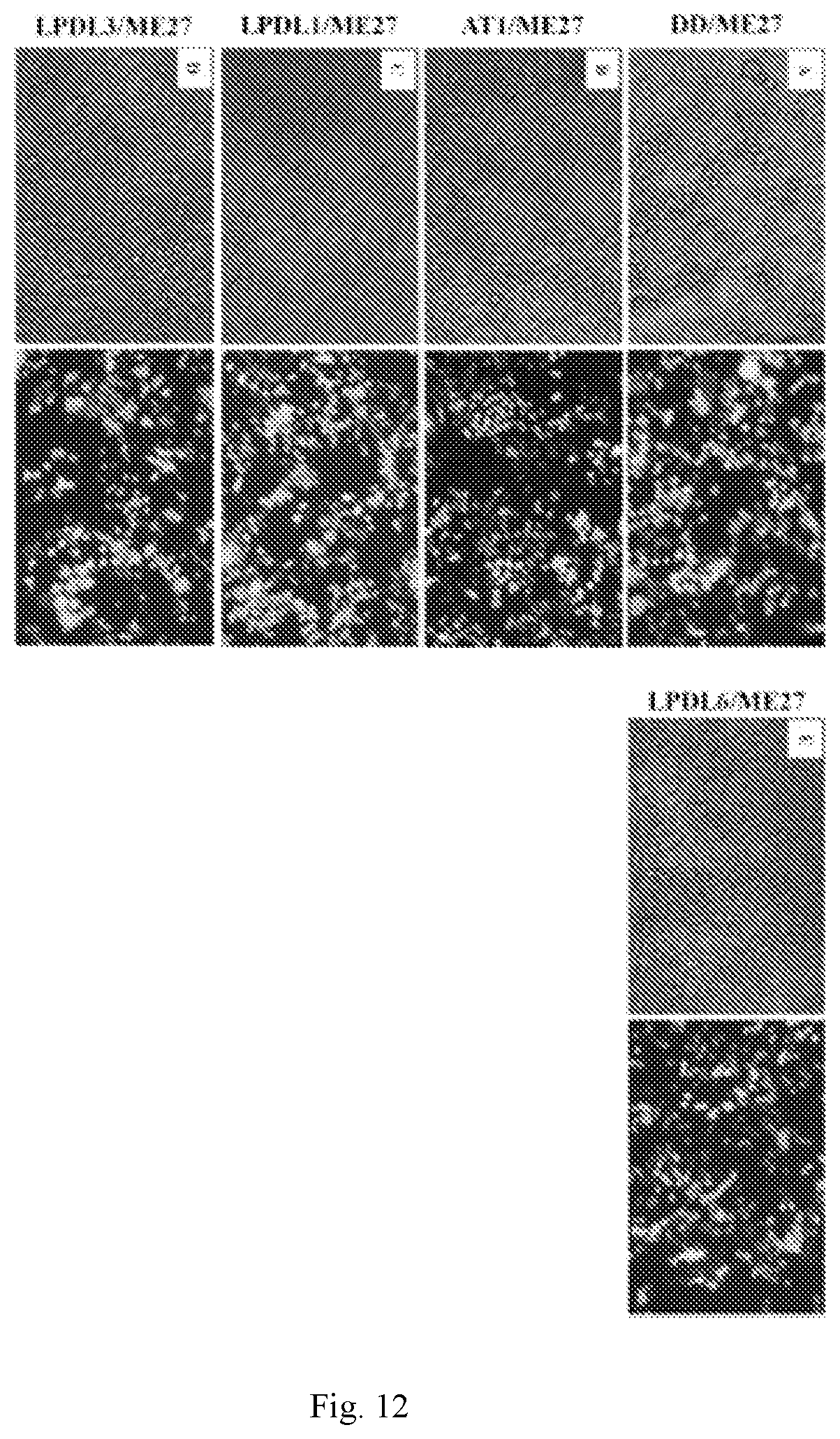 Patent US11793756 Figure 16 – Anionic nanocomplexes for nucleic acid delivery