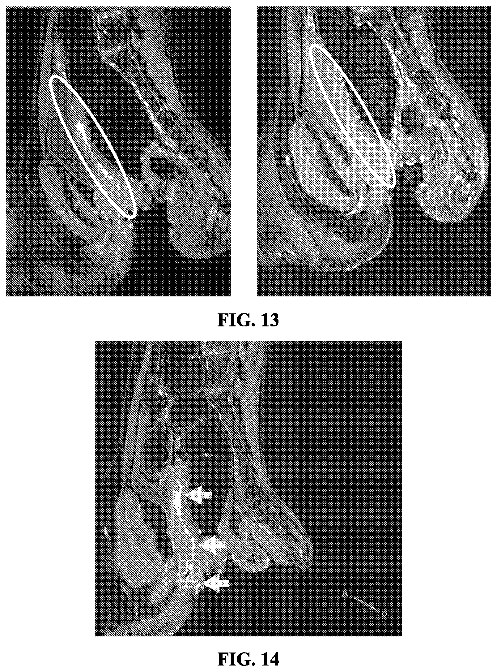 Patent US11793765 Figure 18 – Vaginal films