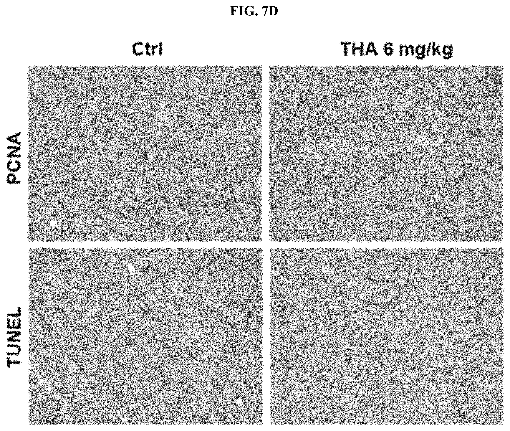 Patent US11793772 Figure 10 – Pharmaceutical composition comprising THA as active ingredient for treating breast cancer