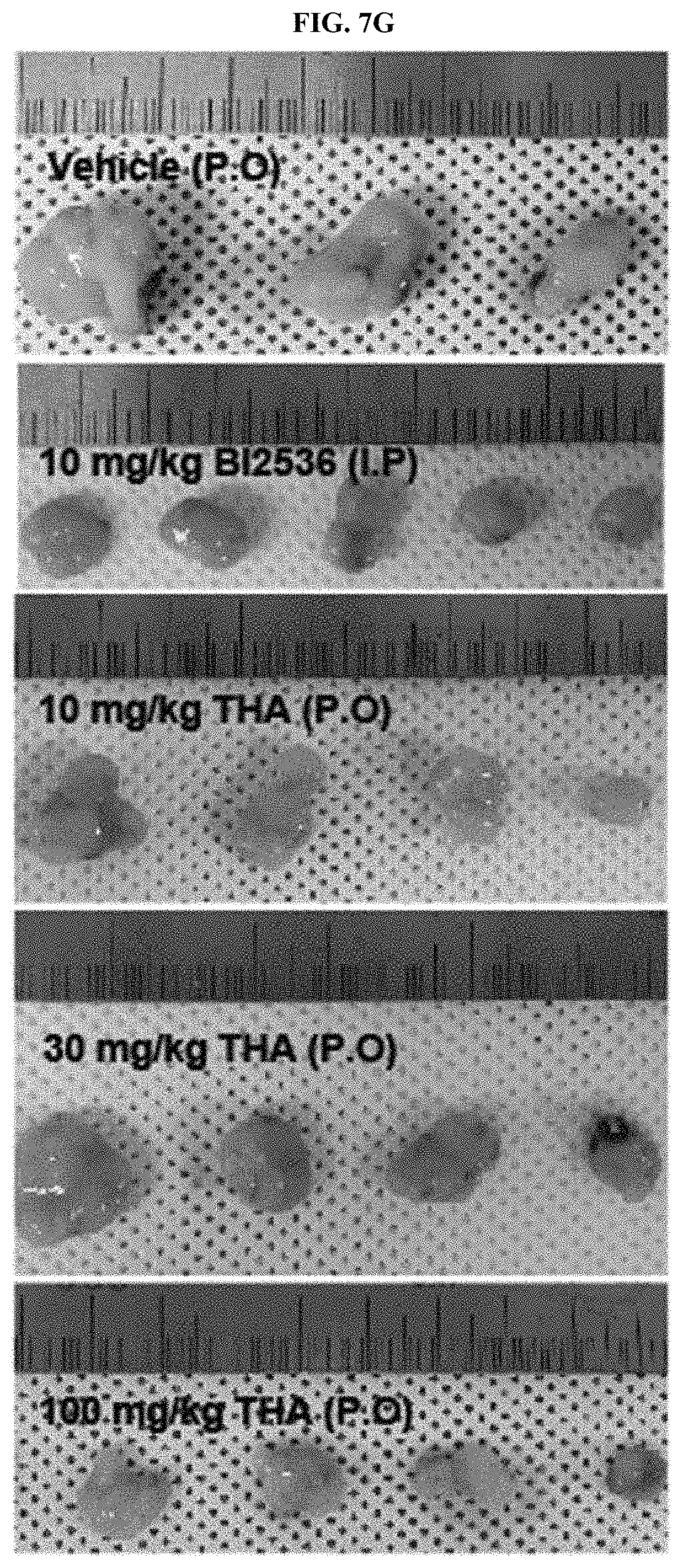Patent US11793772 Figure 13 – Pharmaceutical composition comprising THA as active ingredient for treating breast cancer