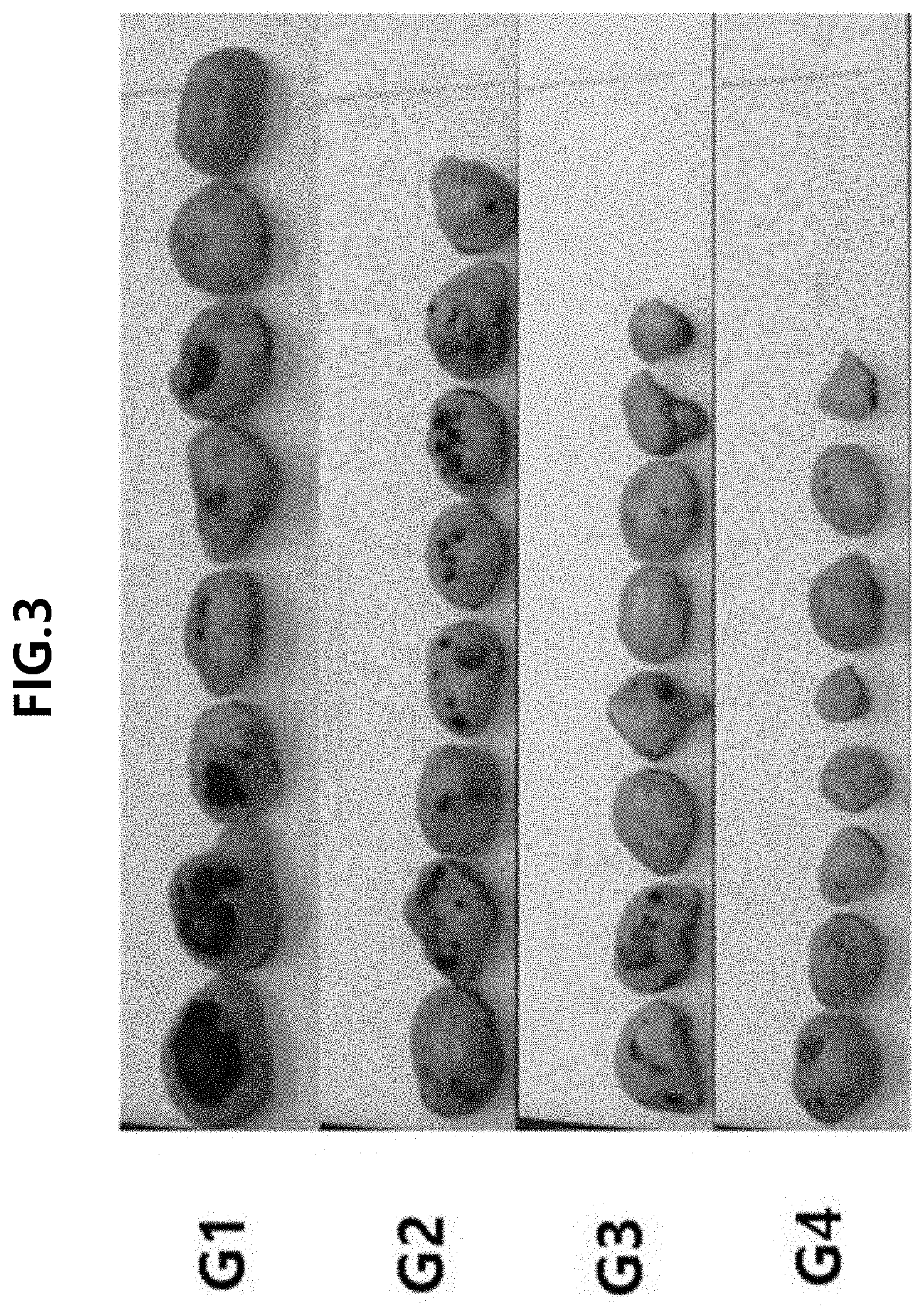 Patent US11793804 Figure 5 – Particle and pharmaceutical composition comprising an insoluble camptothecin compound with double core-shell structure and method for manufacturing the same