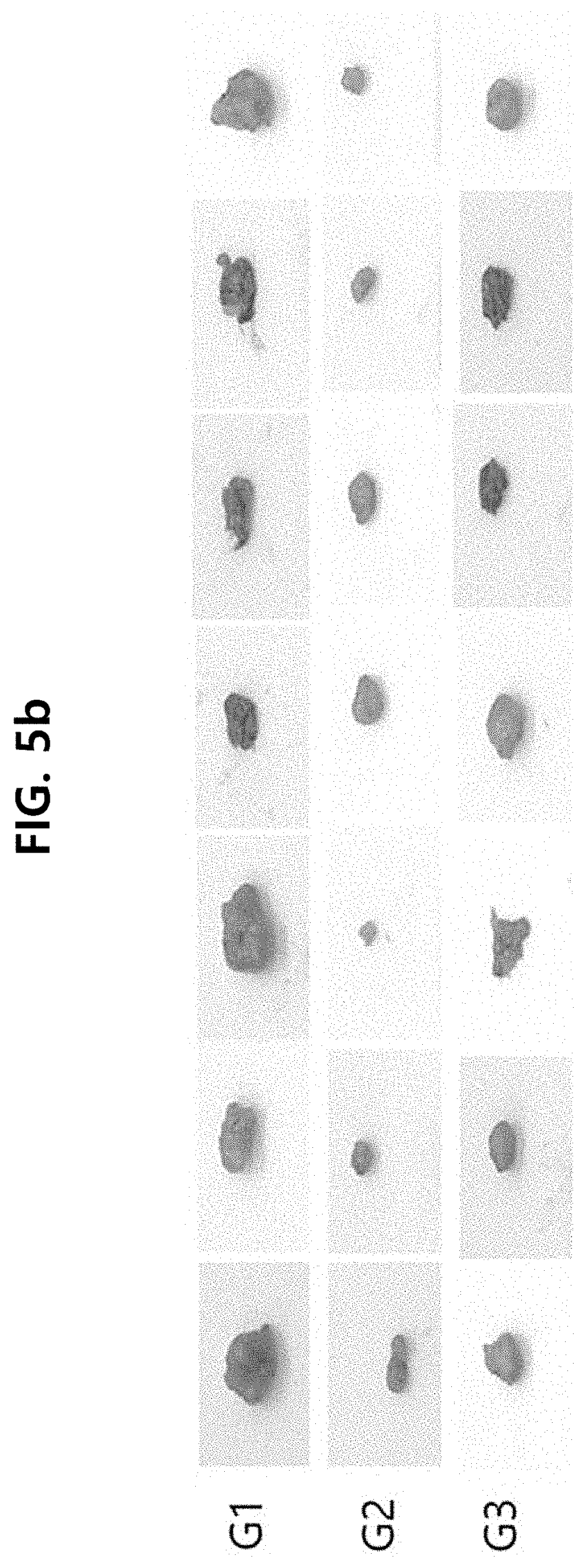 Patent US11793804 Figure 8 – Particle and pharmaceutical composition comprising an insoluble camptothecin compound with double core-shell structure and method for manufacturing the same