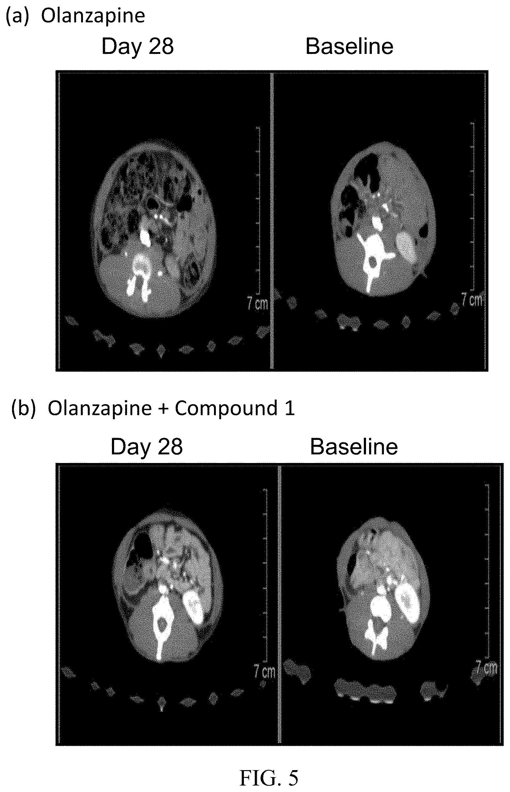 Patent US11793805 Figure 5 – Methods for treating antipsychotic-induced weight gain