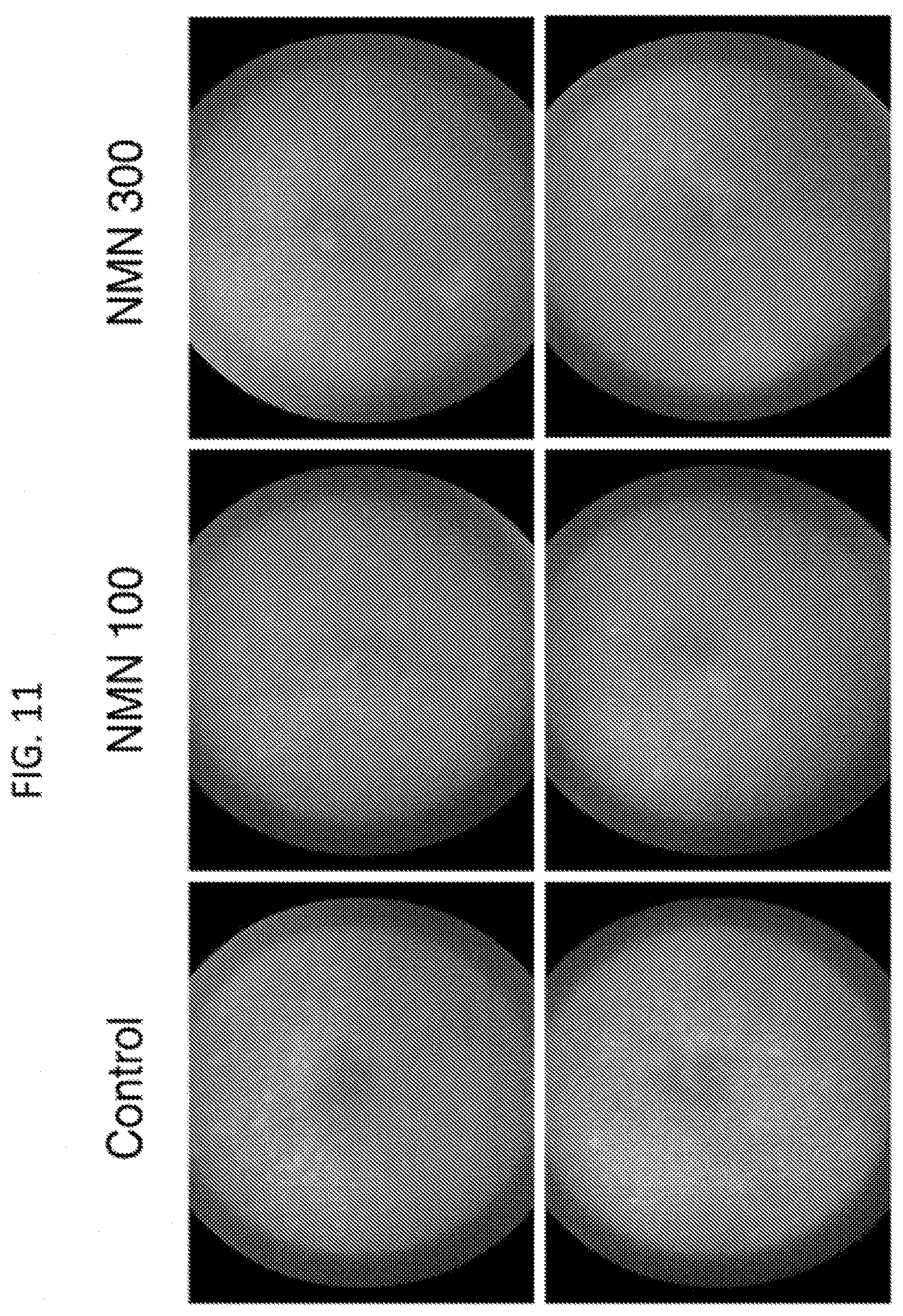 Patent US11793824 Figure 11 – Administration of nicotinamide mononucleotide in the treatment of disease