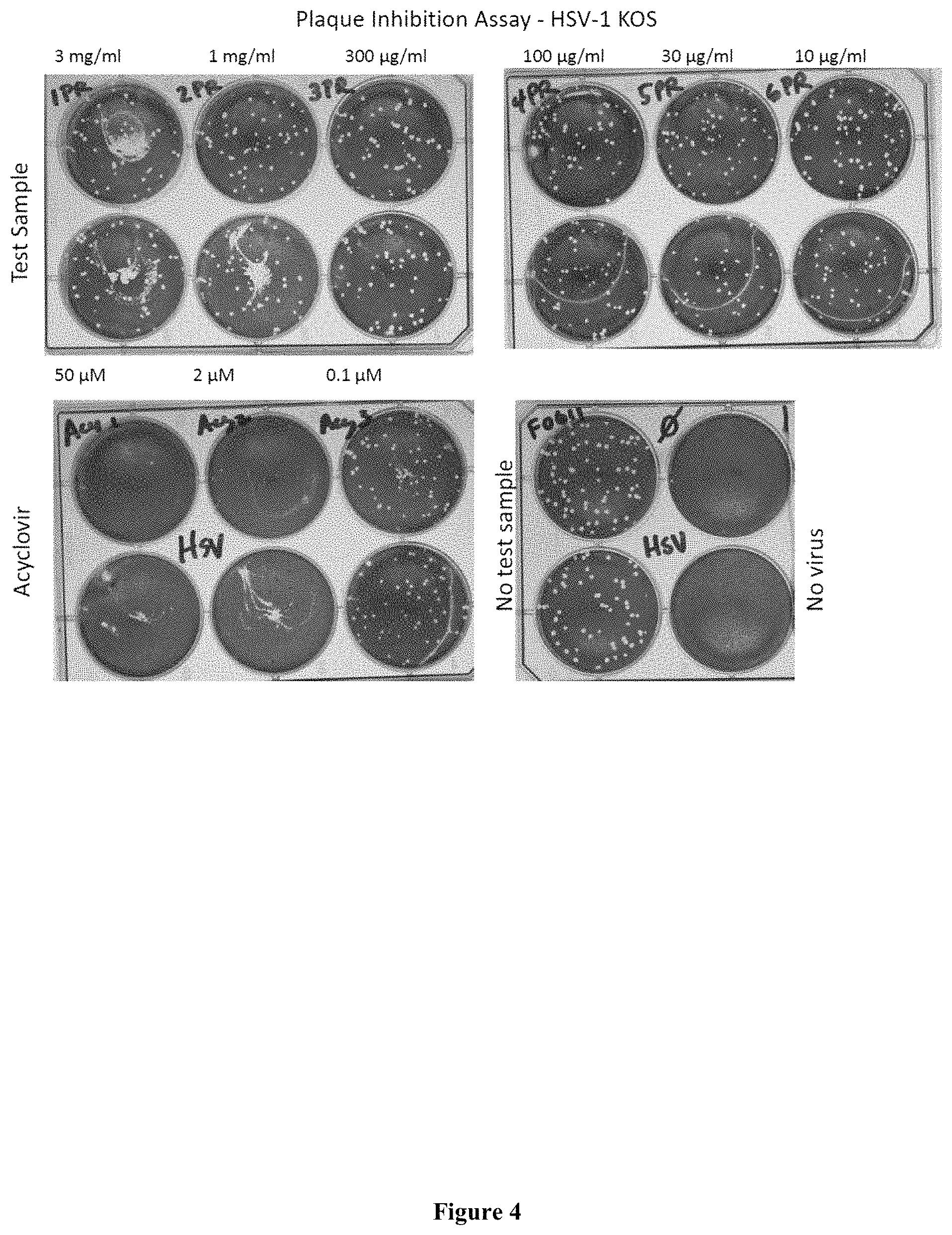 Patent US11793826 Figure 4 – Methods for the use of 5′-adenosine diphosphate ribose (ADPR)
