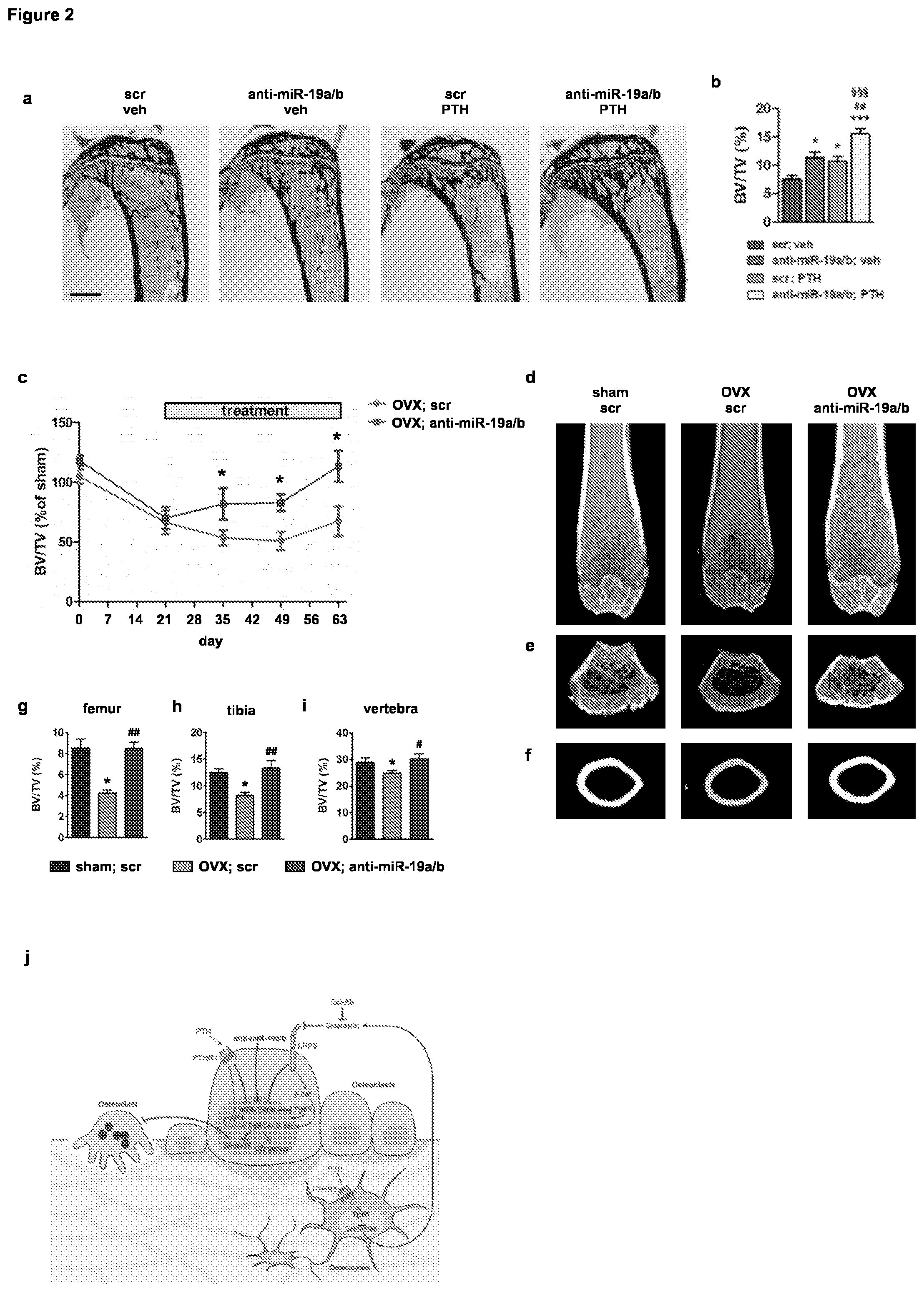 Patent US11793828 Figure 2 – MicroRNA 19A/19B for use in treating a pathological condition associated with bone loss or reduced muscle function