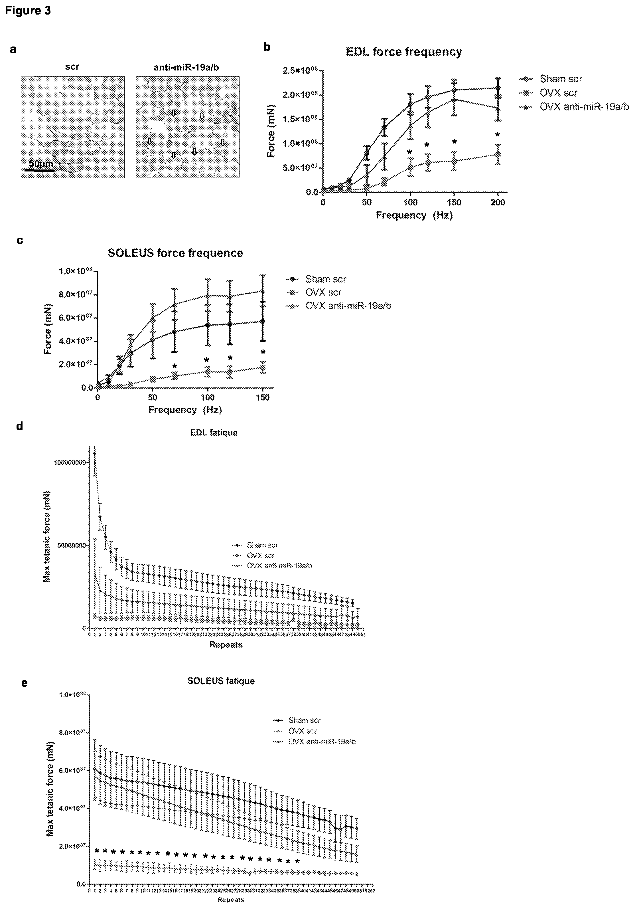 Patent US11793828 Figure 3 – MicroRNA 19A/19B for use in treating a pathological condition associated with bone loss or reduced muscle function