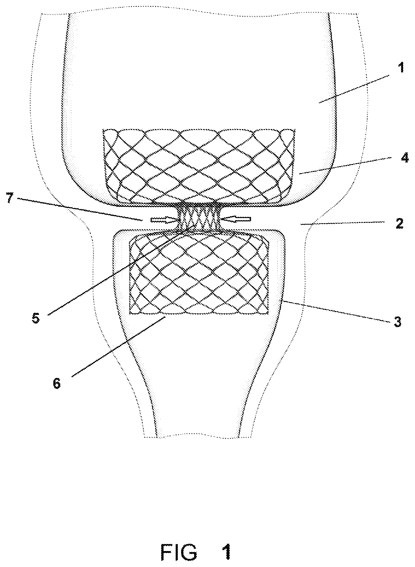 Patent US11793839 Figure 1 – System and method for affecting intestinal microbial flora
