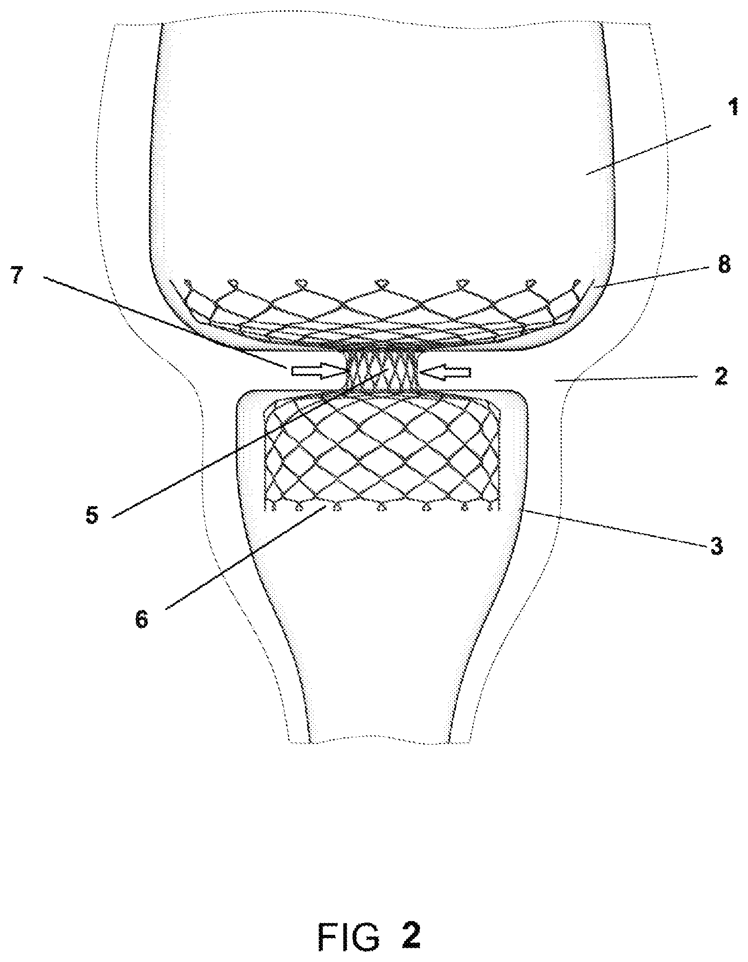 Patent US11793839 Figure 2 – System and method for affecting intestinal microbial flora