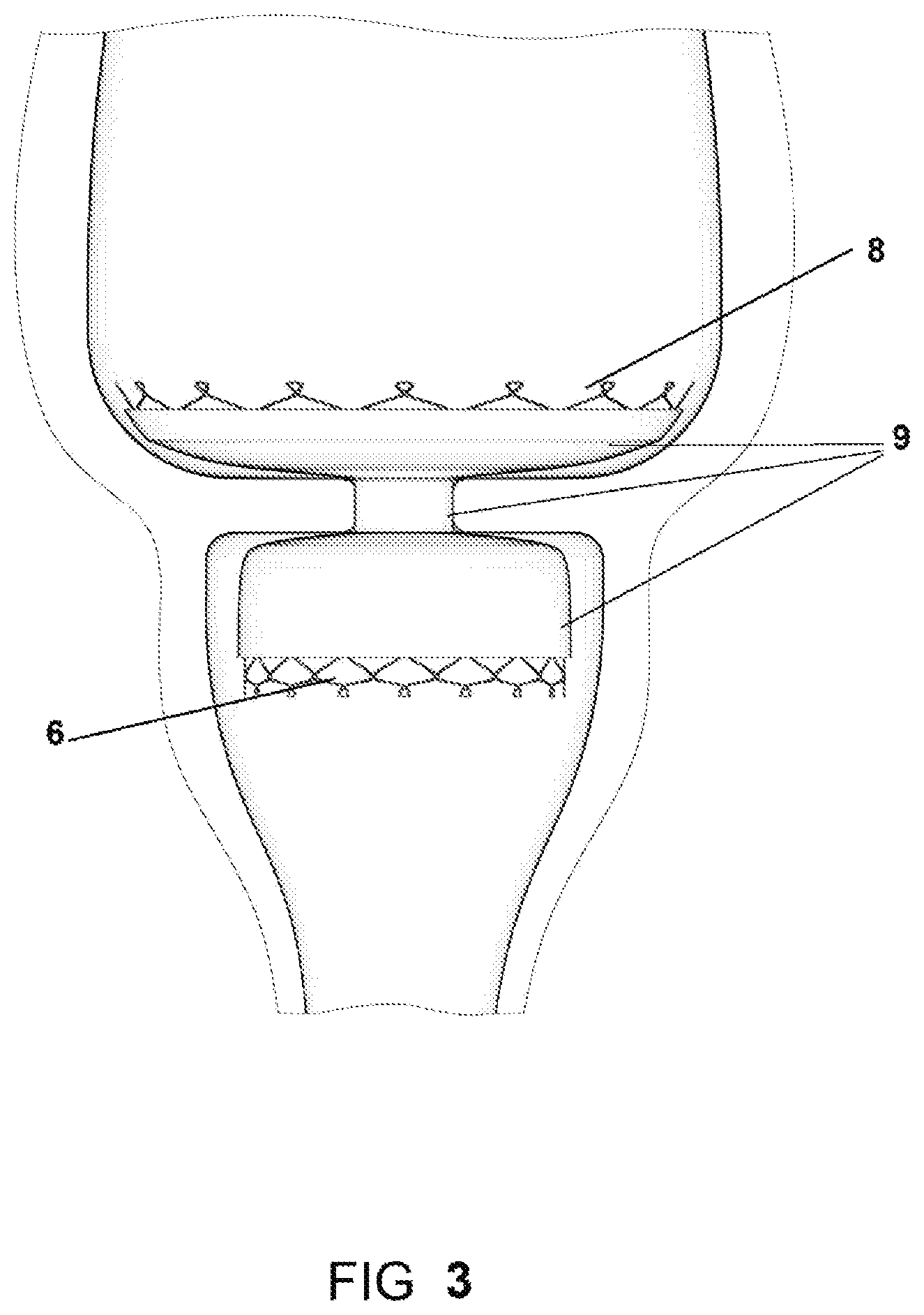 Patent US11793839 Figure 3 – System and method for affecting intestinal microbial flora