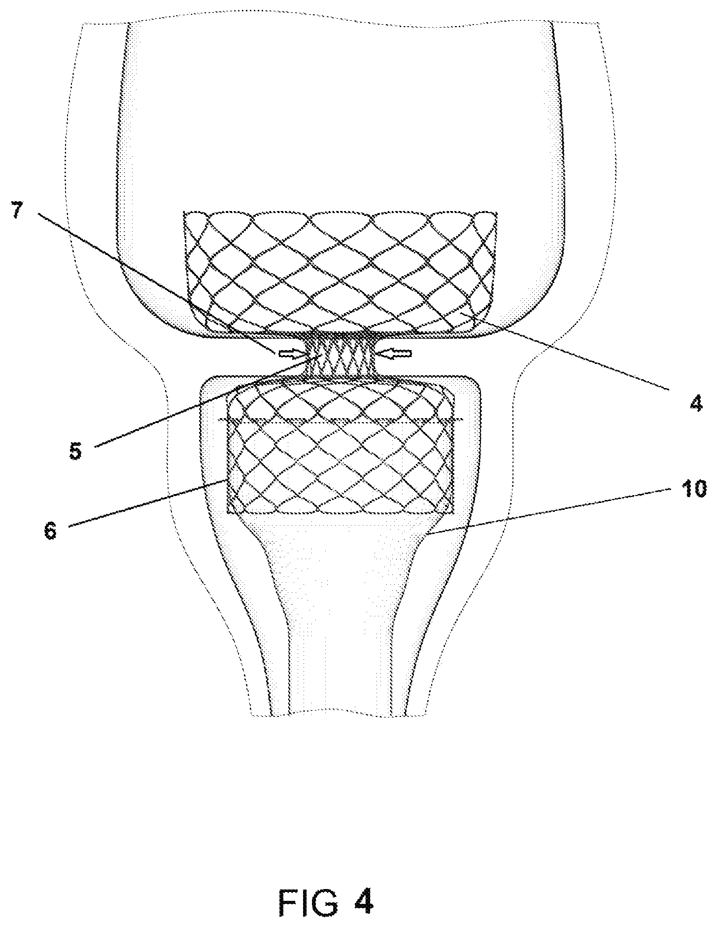 Patent US11793839 Figure 4 – System and method for affecting intestinal microbial flora