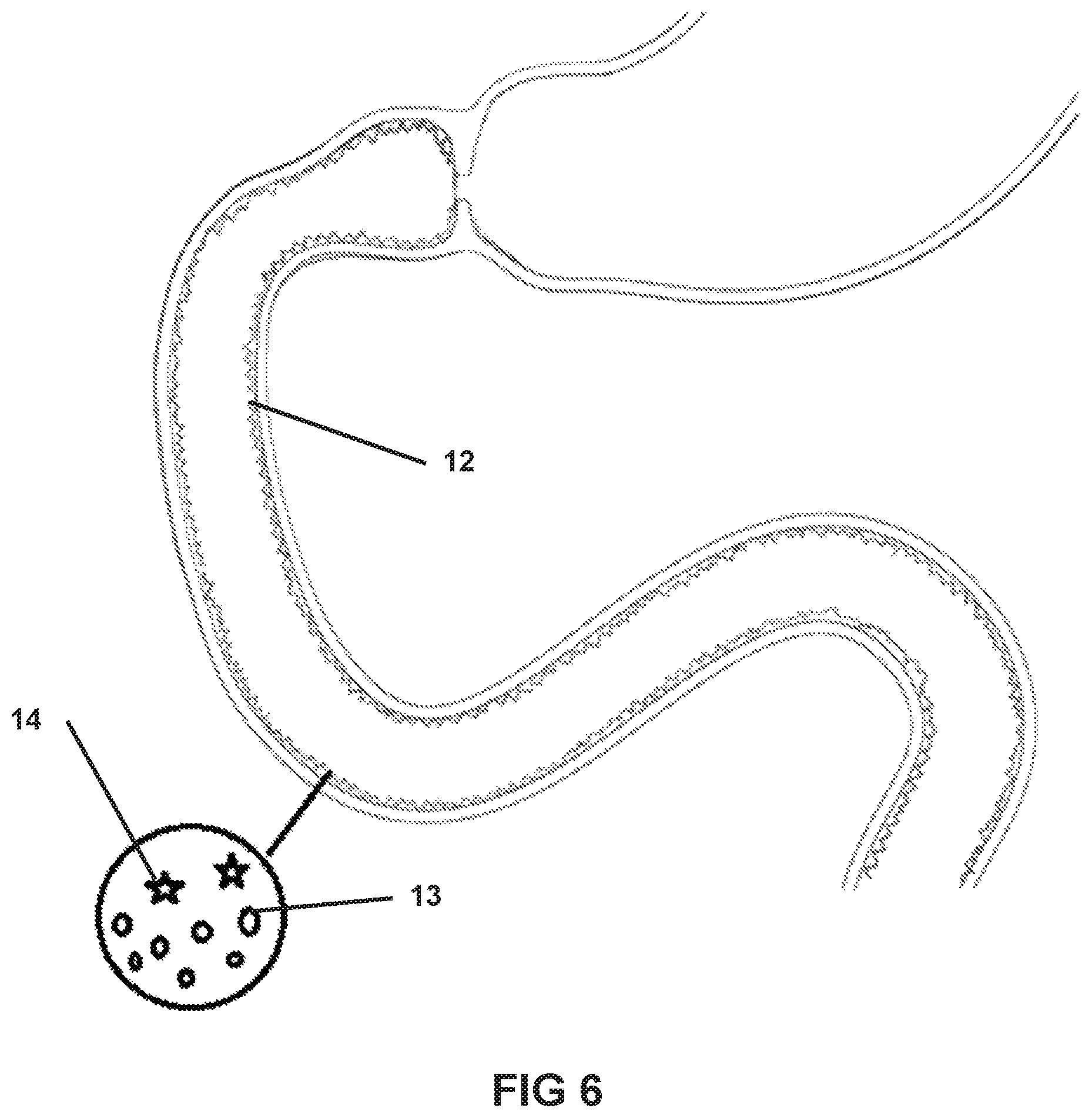 Patent US11793839 Figure 6 – System and method for affecting intestinal microbial flora