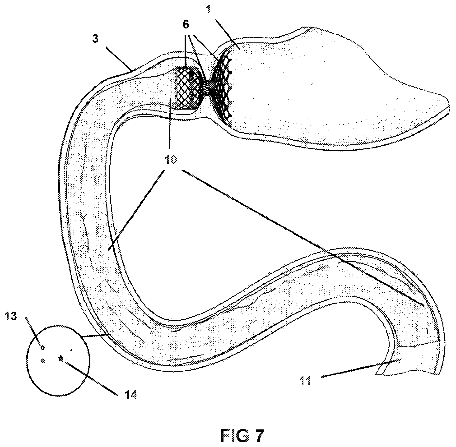 Patent US11793839 Figure 7 – System and method for affecting intestinal microbial flora