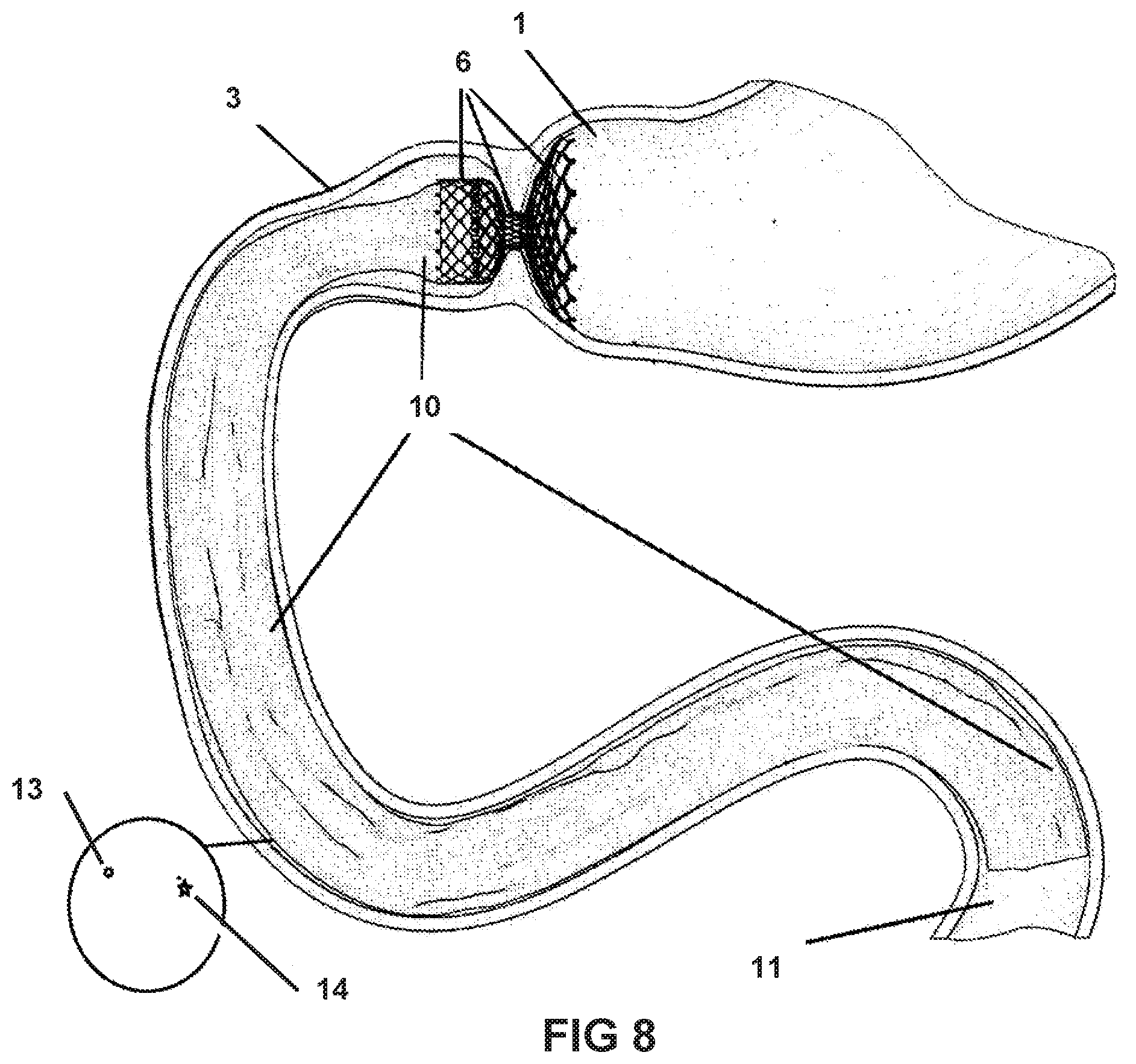 Patent US11793839 Figure 8 – System and method for affecting intestinal microbial flora