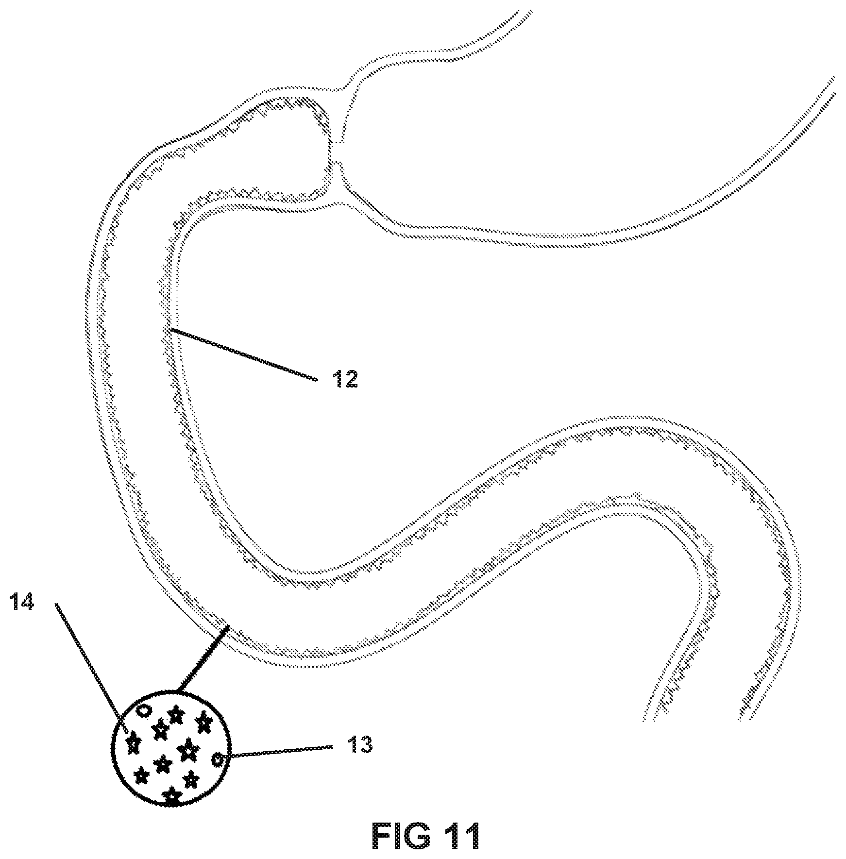 Patent US11793839 Figure 11 – System and method for affecting intestinal microbial flora