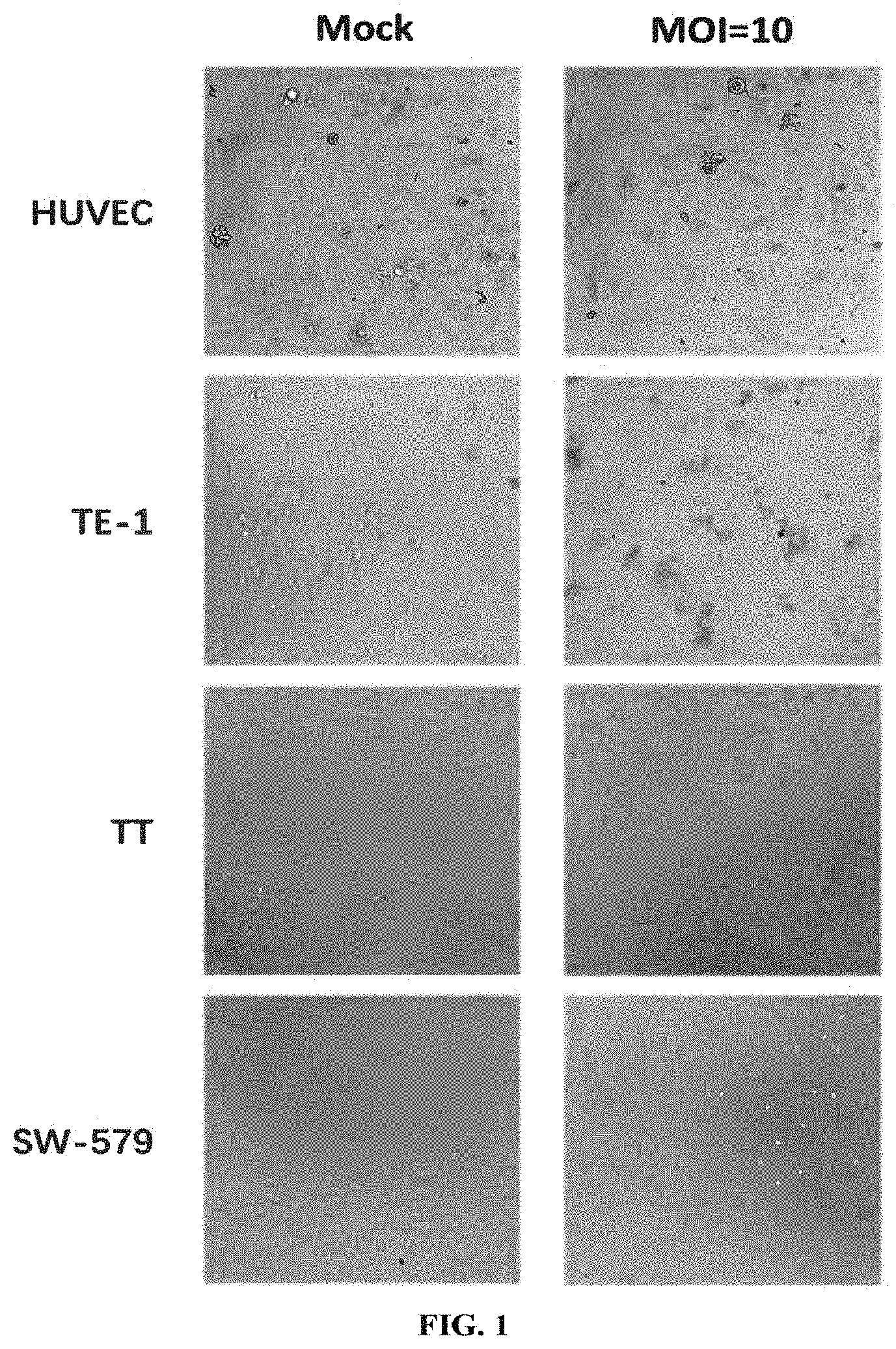 Patent US11793844 — Virus for treatment of tumor — Figure 1