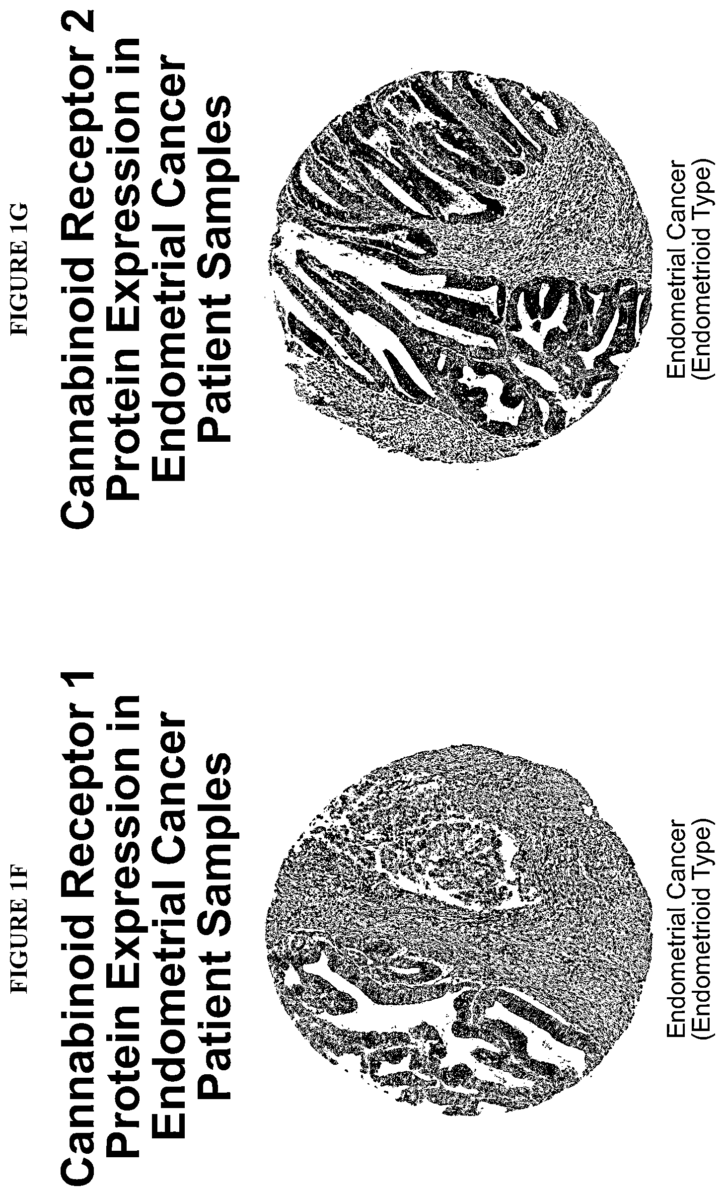 Patent US11793847 Figure 3 – Methods of treating endometrial cancer using hemp extract