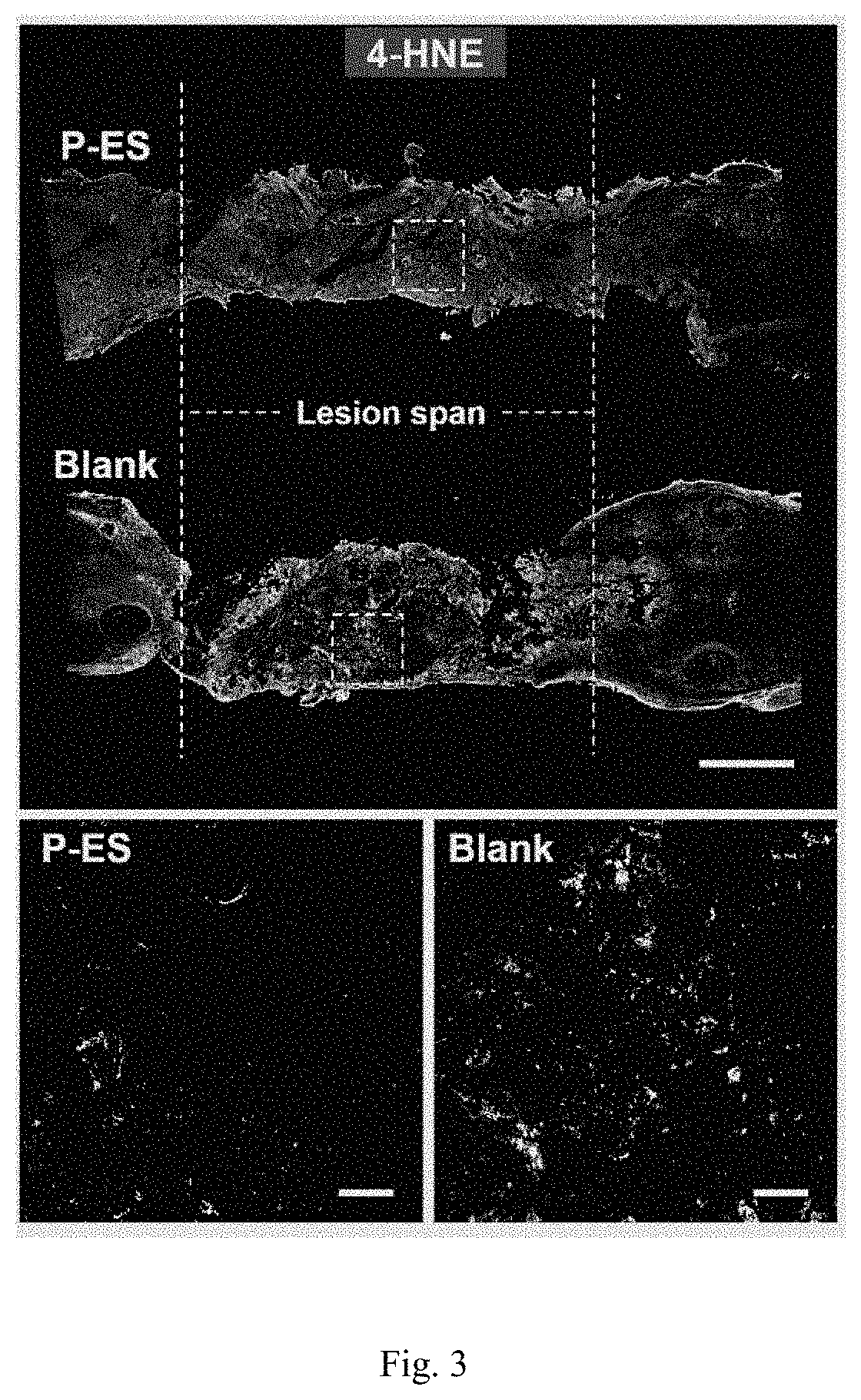 Patent US11793850 Figure 2 – Plant-derived exosome as well as preparation method and application thereof