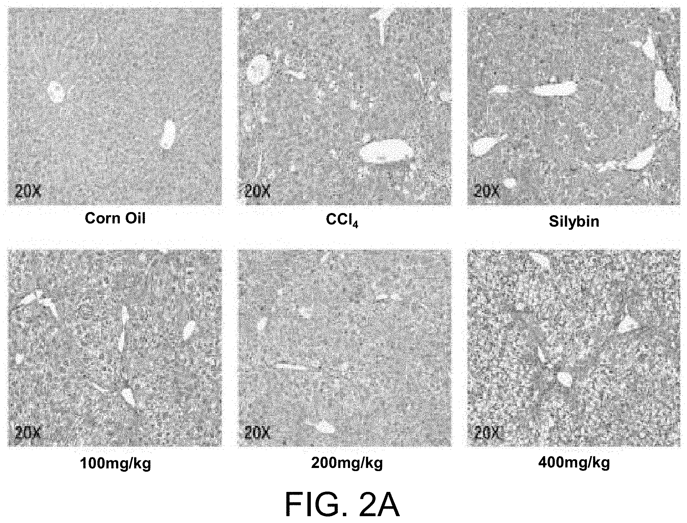Patent US11793852 Figure 2 – Application of Longhu Rendan in preparing medicament for preventing and/or treating liver fibrosis