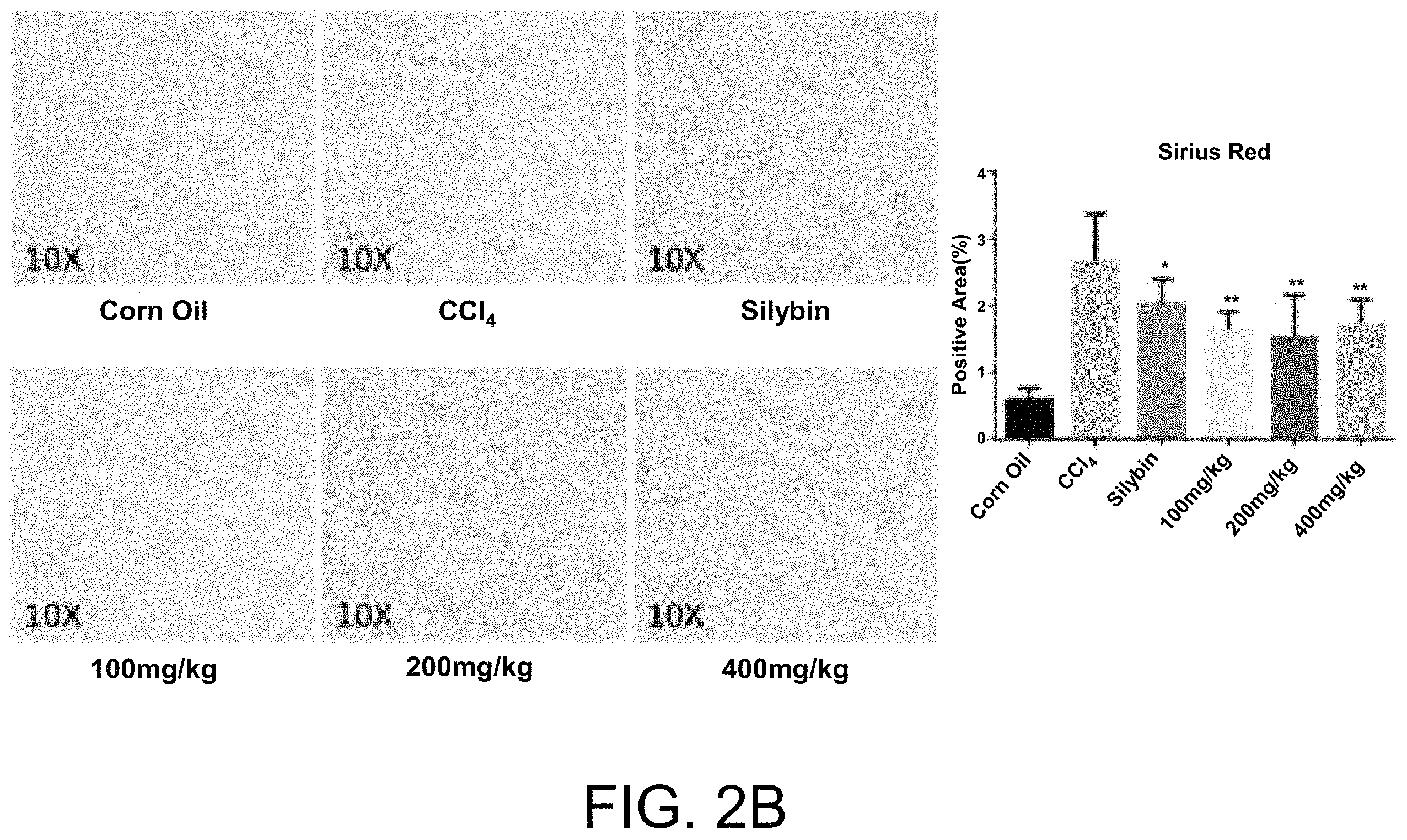 Patent US11793852 Figure 3 – Application of Longhu Rendan in preparing medicament for preventing and/or treating liver fibrosis