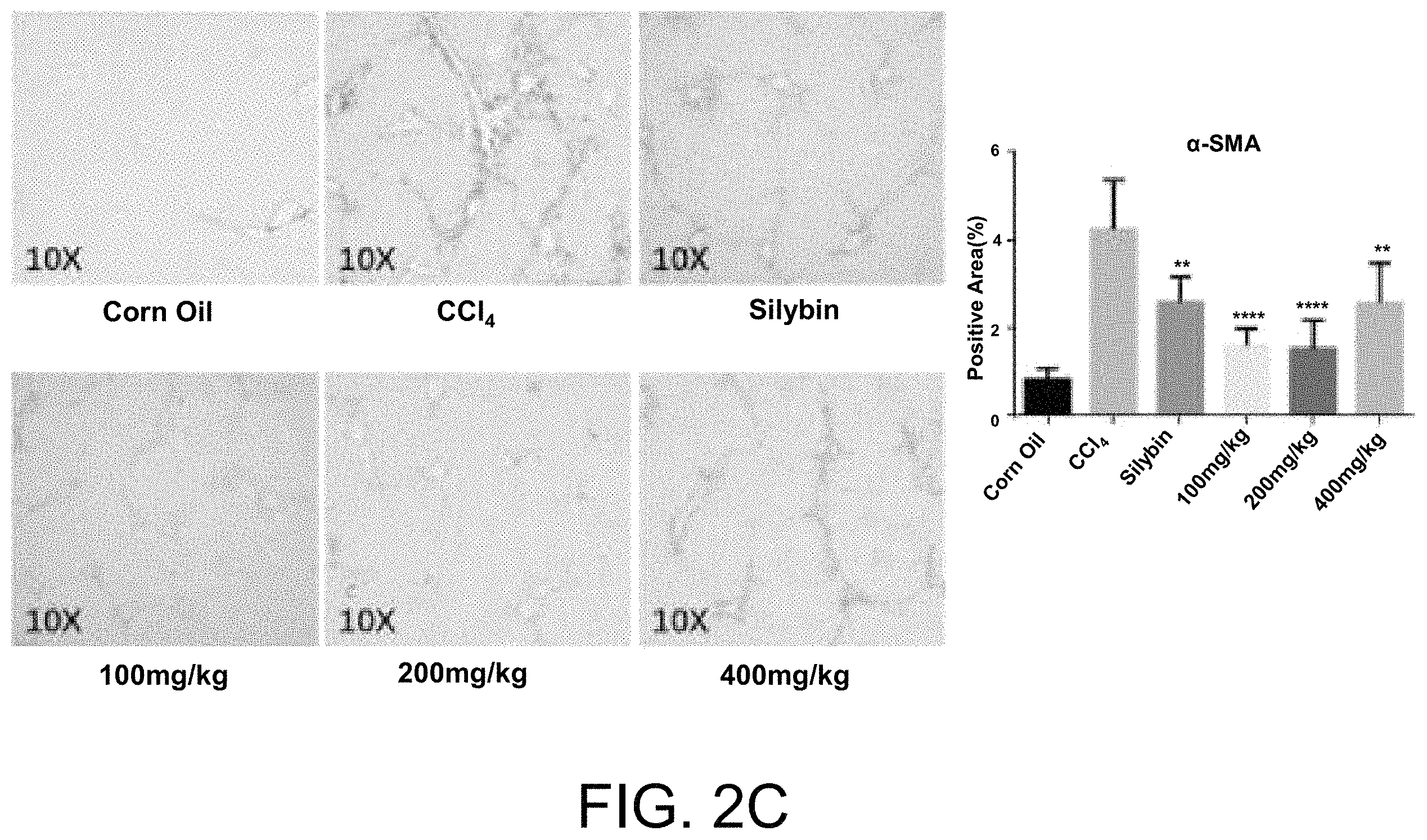Patent US11793852 Figure 4 – Application of Longhu Rendan in preparing medicament for preventing and/or treating liver fibrosis