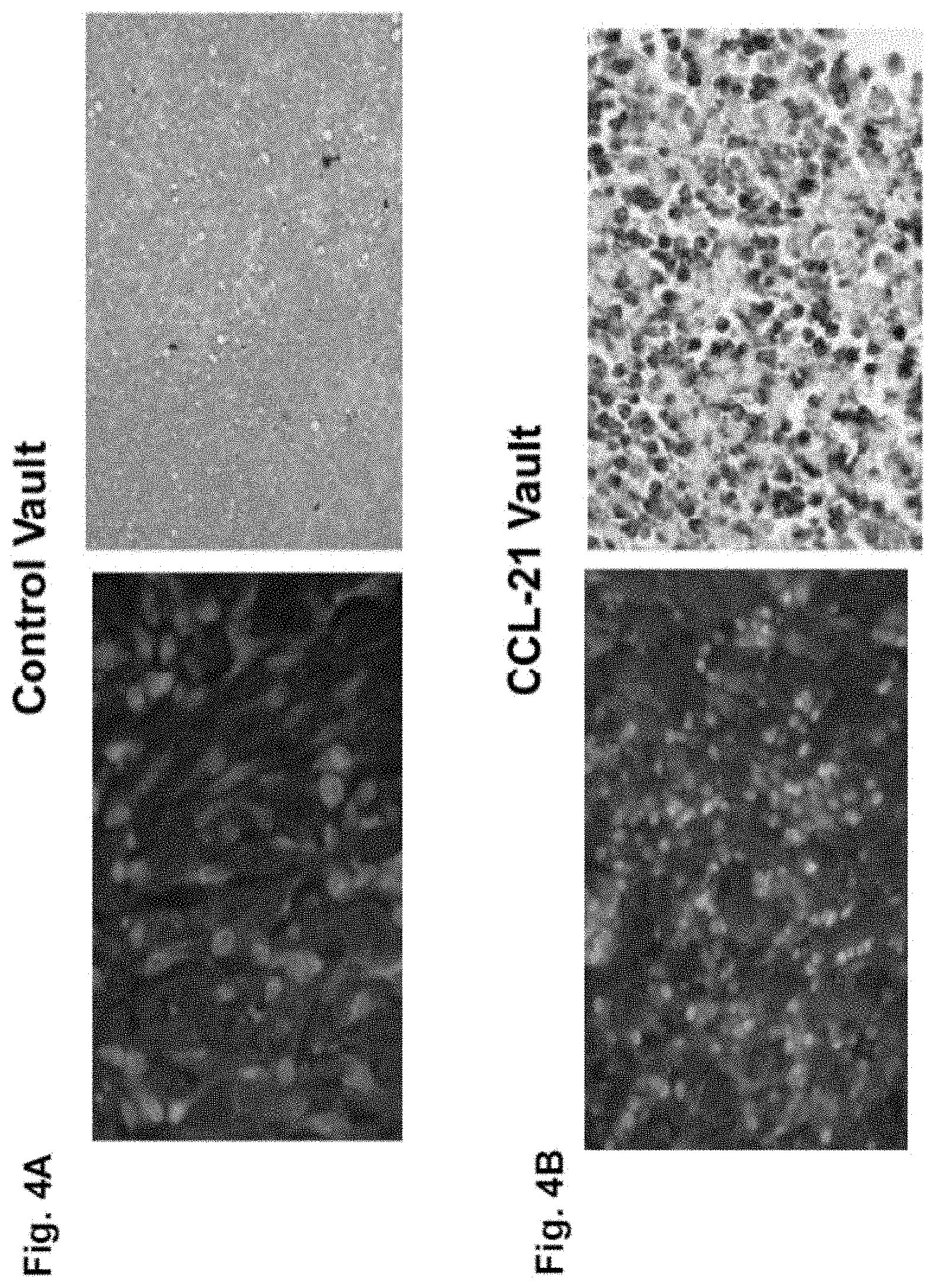 Patent US11793860 Figure 4 – Vault complexes for cytokine delivery