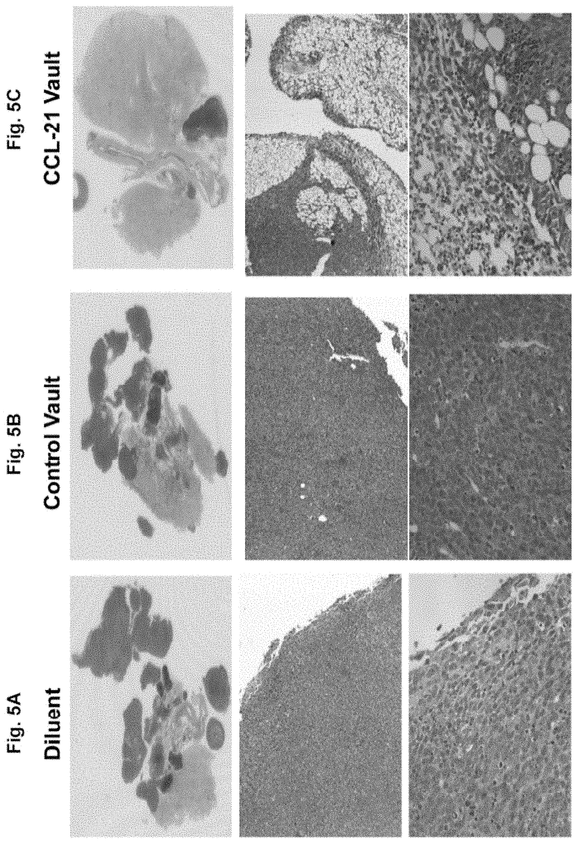 Patent US11793860 Figure 5 – Vault complexes for cytokine delivery