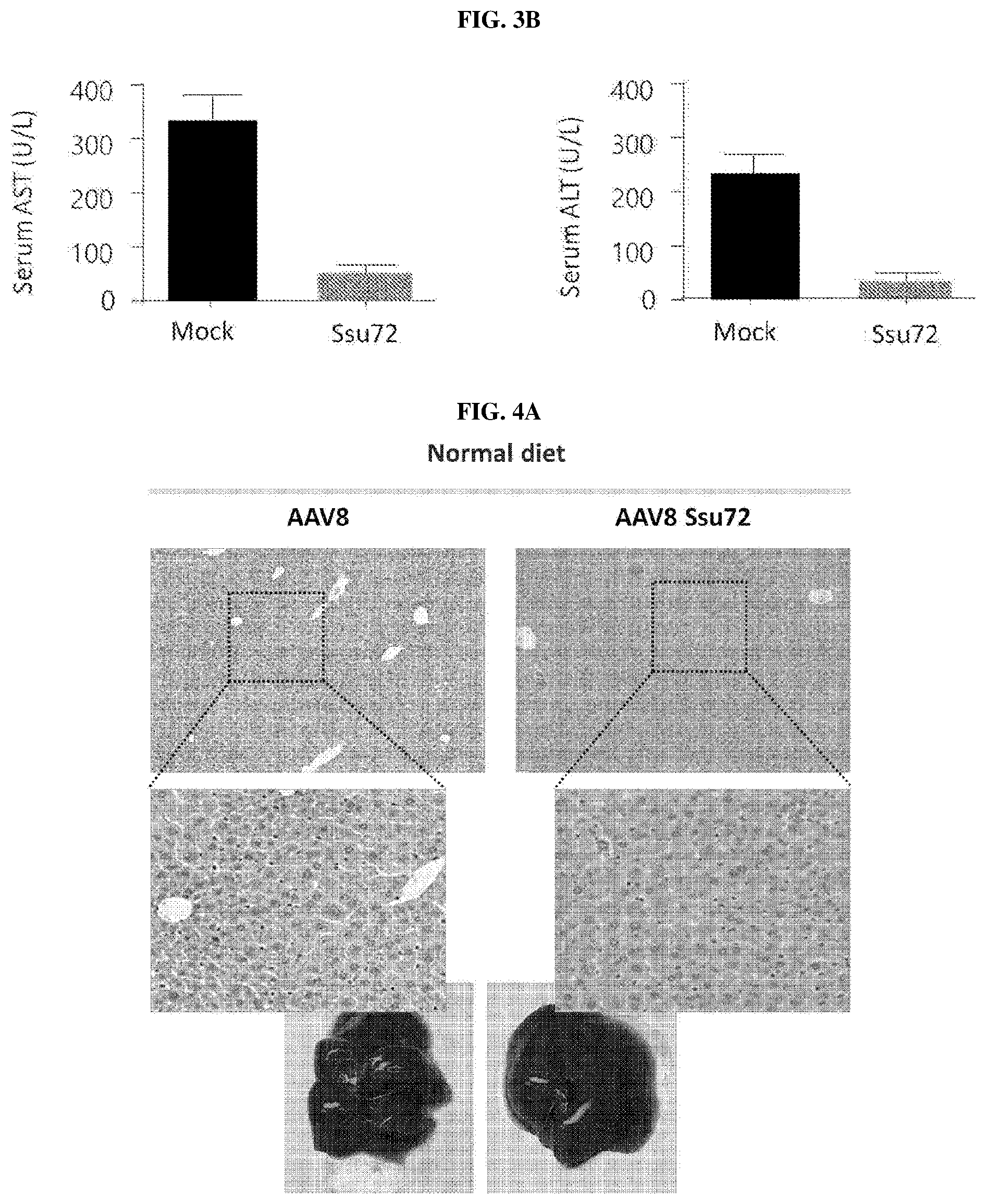 Patent US11793862 Figure 2 – Pharmaceutical composition for treating non-alcoholic fatty liver, non-alcoholic steatohepatitis, or hepatic fibrosis using Ssu72 protein or a polynucleotide encoding the same