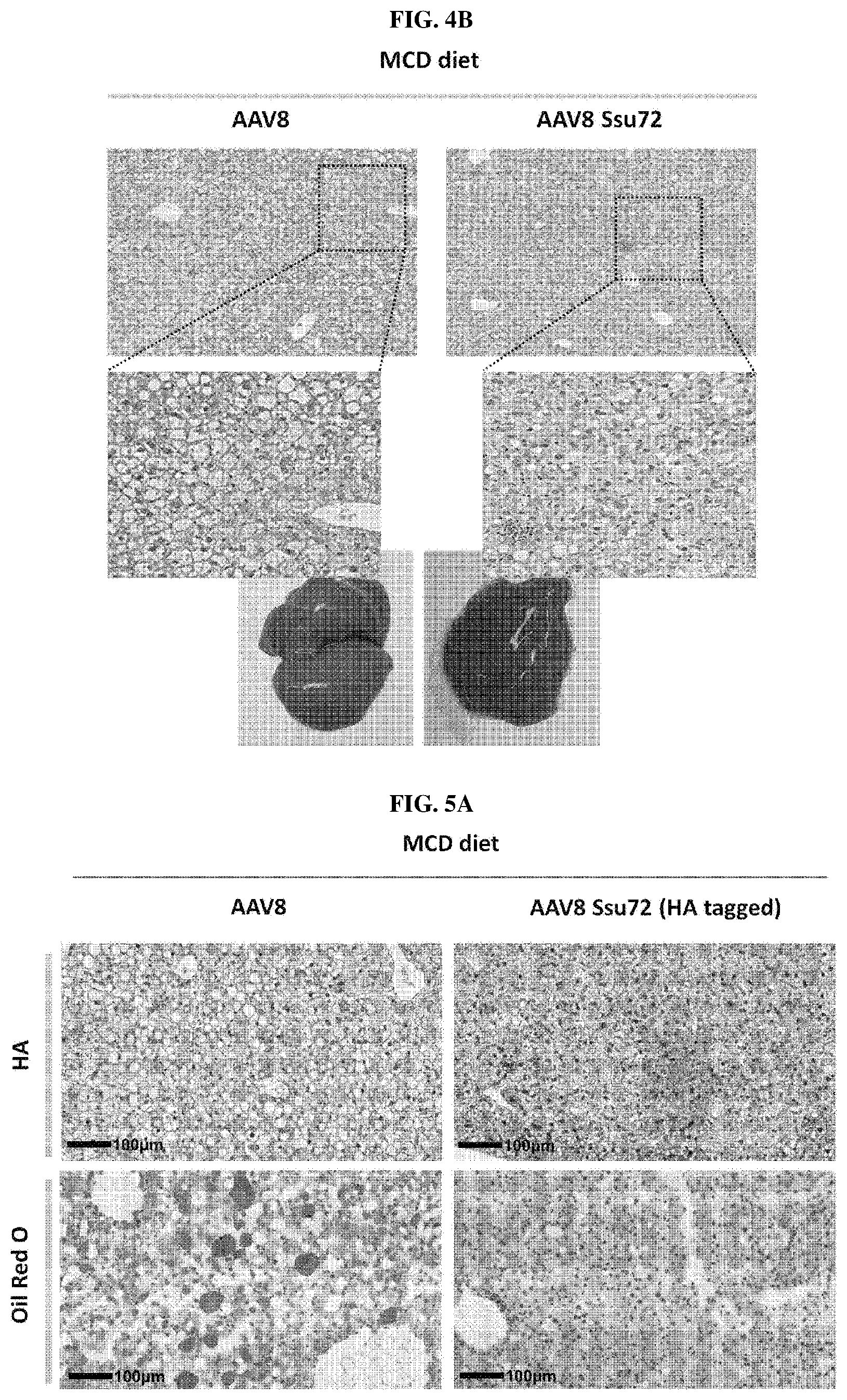 Patent US11793862 Figure 3 – Pharmaceutical composition for treating non-alcoholic fatty liver, non-alcoholic steatohepatitis, or hepatic fibrosis using Ssu72 protein or a polynucleotide encoding the same