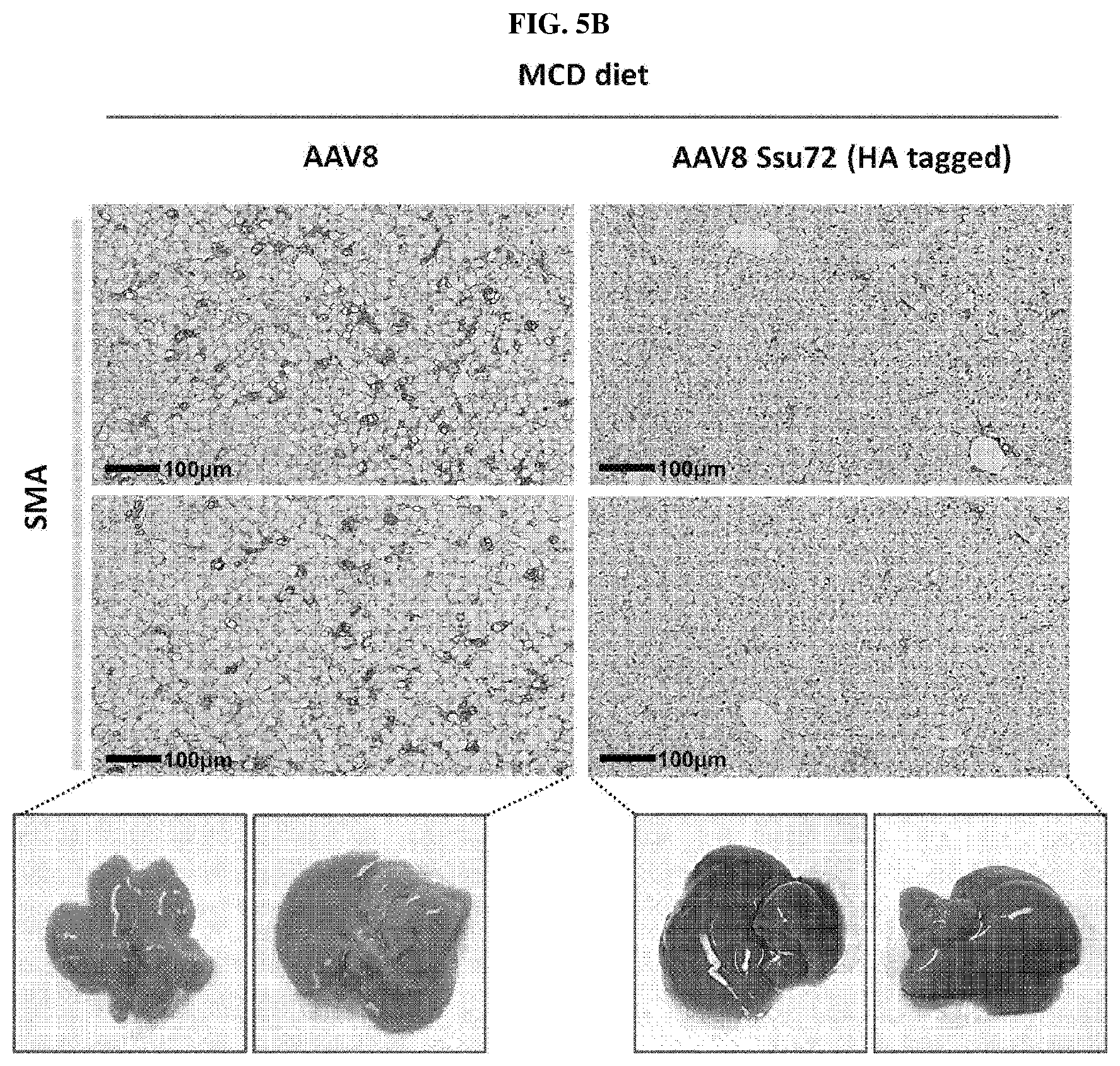 Patent US11793862 Figure 4 – Pharmaceutical composition for treating non-alcoholic fatty liver, non-alcoholic steatohepatitis, or hepatic fibrosis using Ssu72 protein or a polynucleotide encoding the same