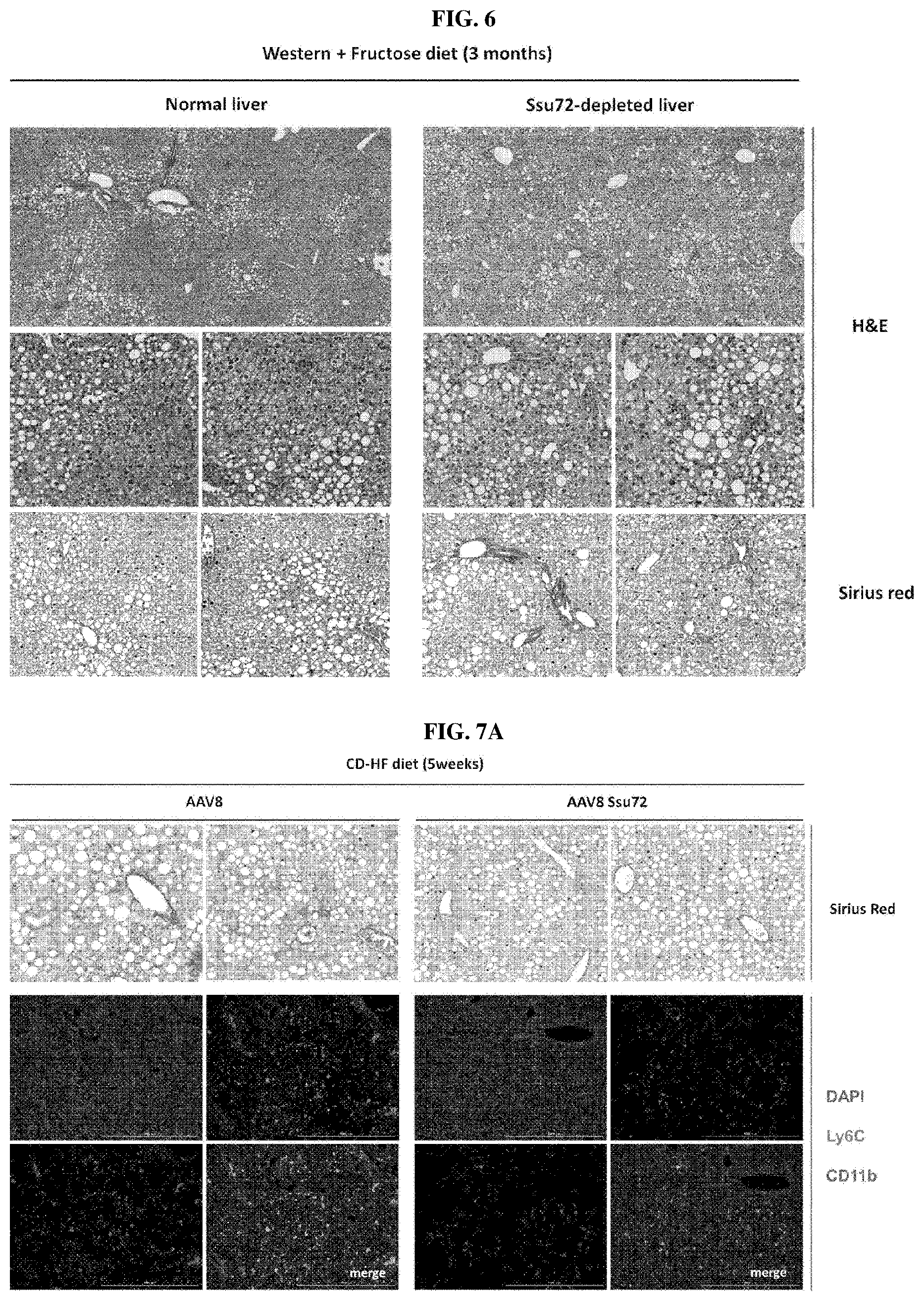 Patent US11793862 Figure 5 – Pharmaceutical composition for treating non-alcoholic fatty liver, non-alcoholic steatohepatitis, or hepatic fibrosis using Ssu72 protein or a polynucleotide encoding the same