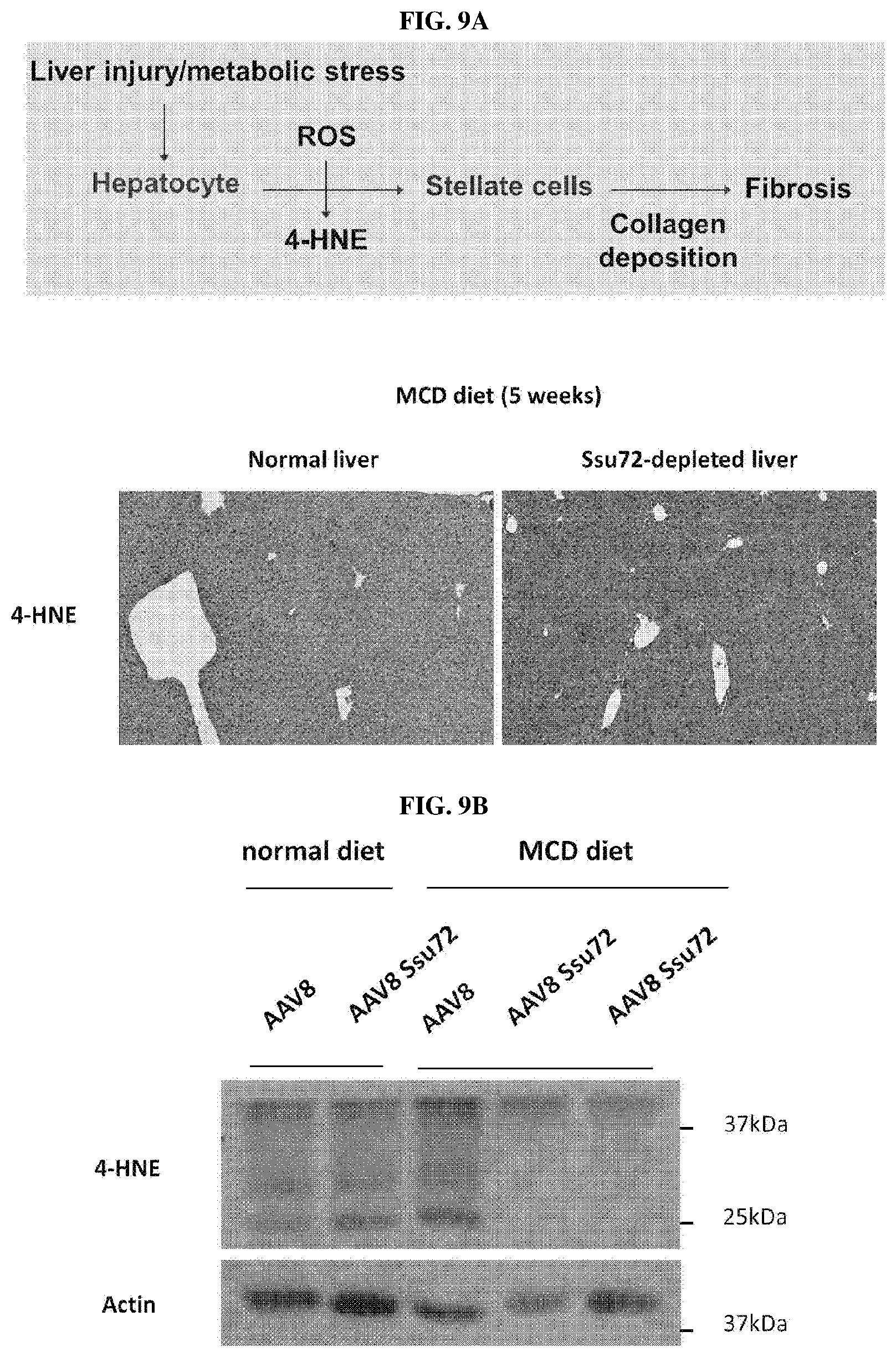 Patent US11793862 Figure 9 – Pharmaceutical composition for treating non-alcoholic fatty liver, non-alcoholic steatohepatitis, or hepatic fibrosis using Ssu72 protein or a polynucleotide encoding the same