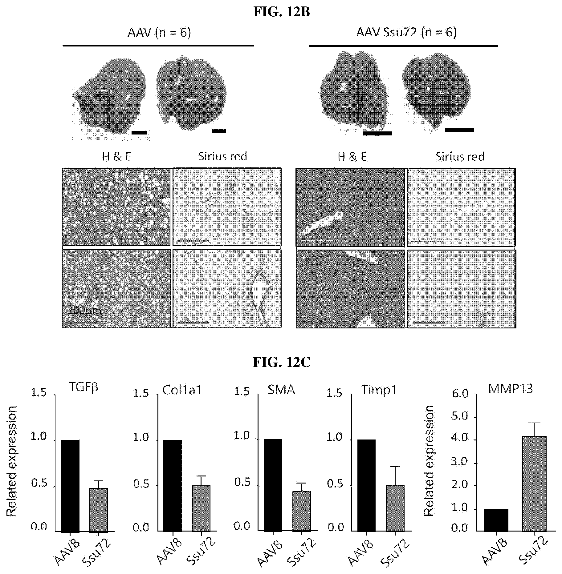 Patent US11793862 Figure 13 – Pharmaceutical composition for treating non-alcoholic fatty liver, non-alcoholic steatohepatitis, or hepatic fibrosis using Ssu72 protein or a polynucleotide encoding the same