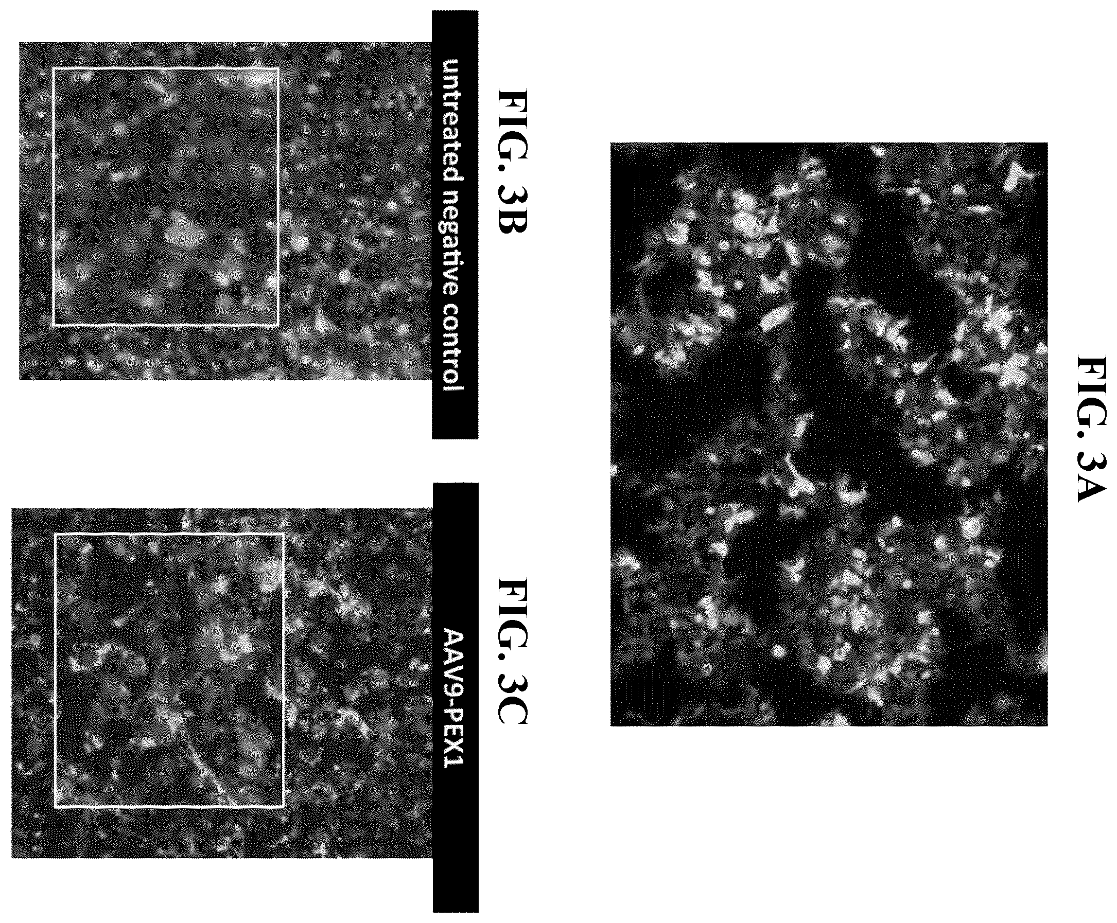Patent US11793887 Figure 5 – Gene therapy for treating peroxisomal disorders