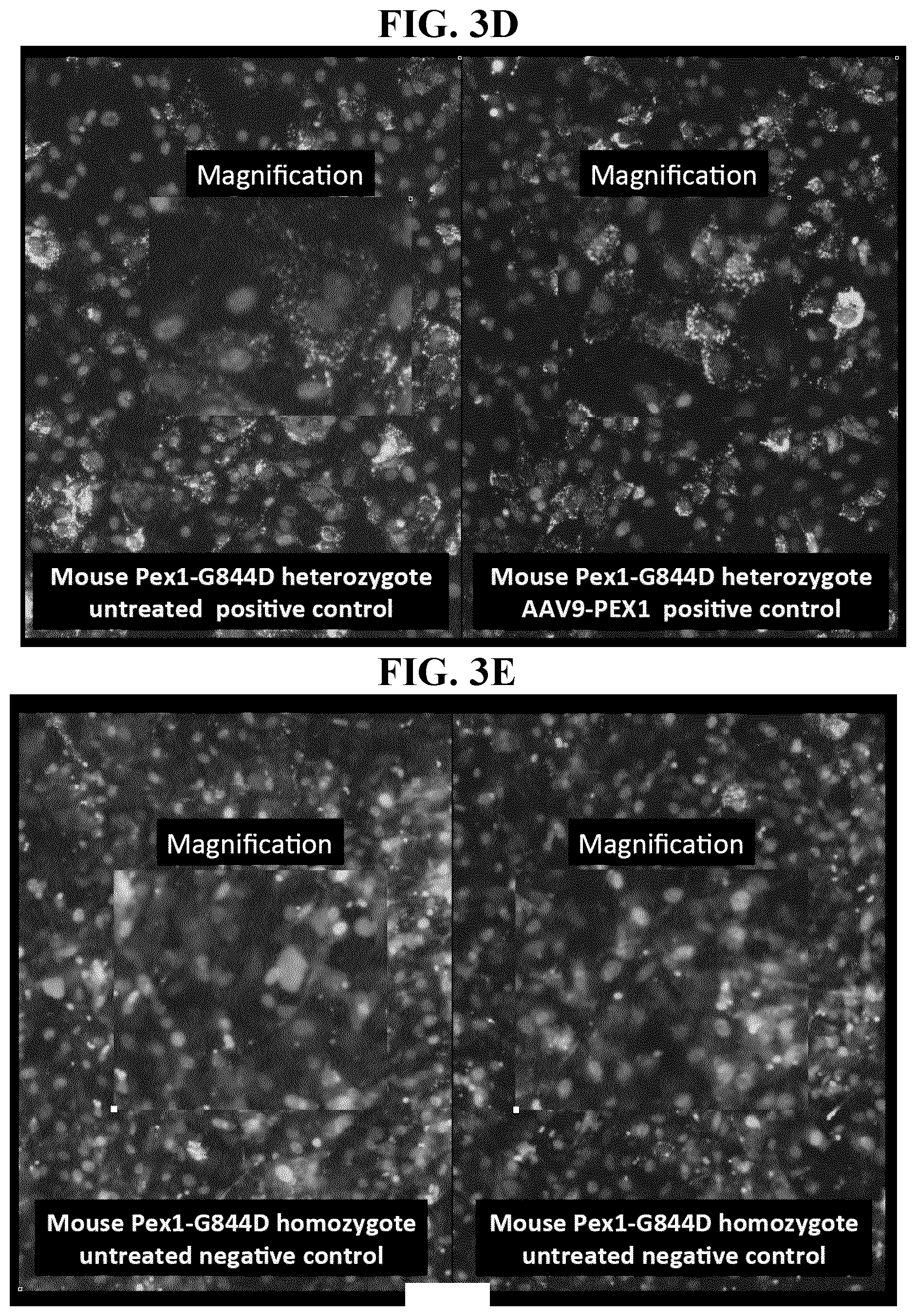 Patent US11793887 Figure 6 – Gene therapy for treating peroxisomal disorders