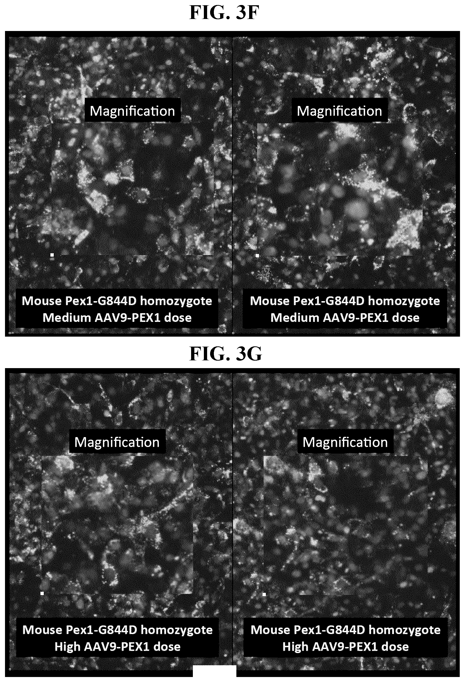 Patent US11793887 Figure 7 – Gene therapy for treating peroxisomal disorders